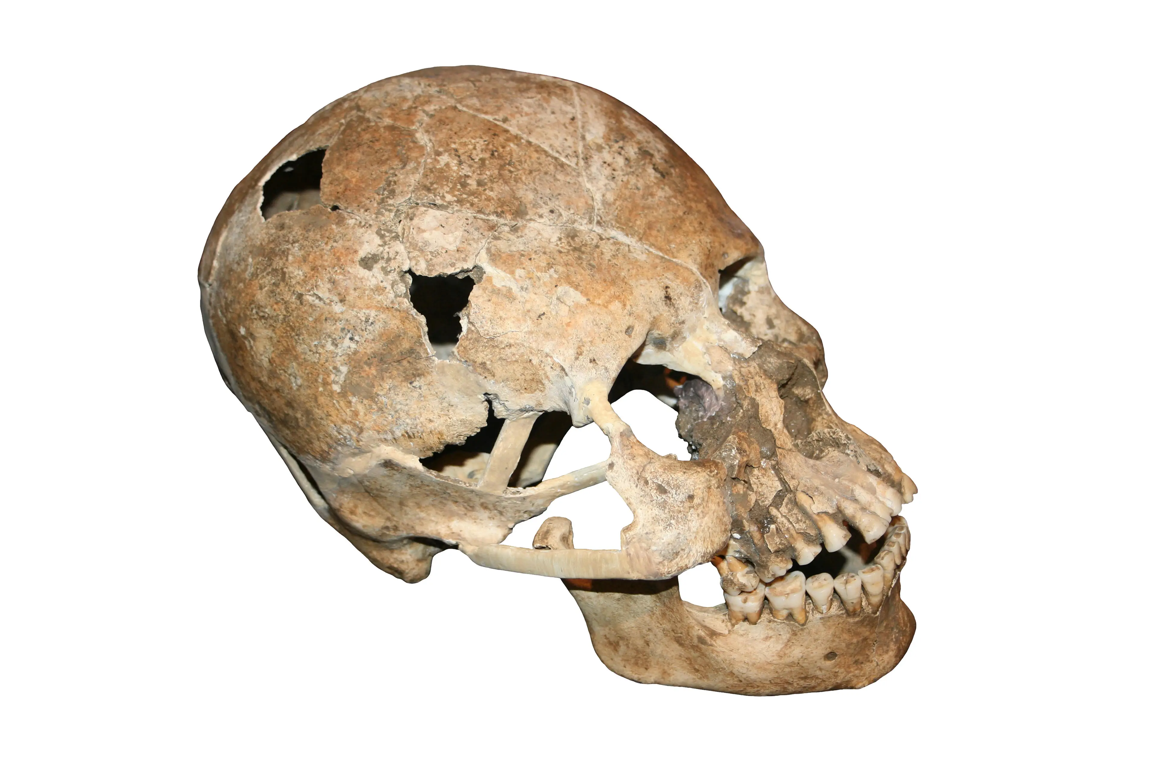 The practice took place across the world.