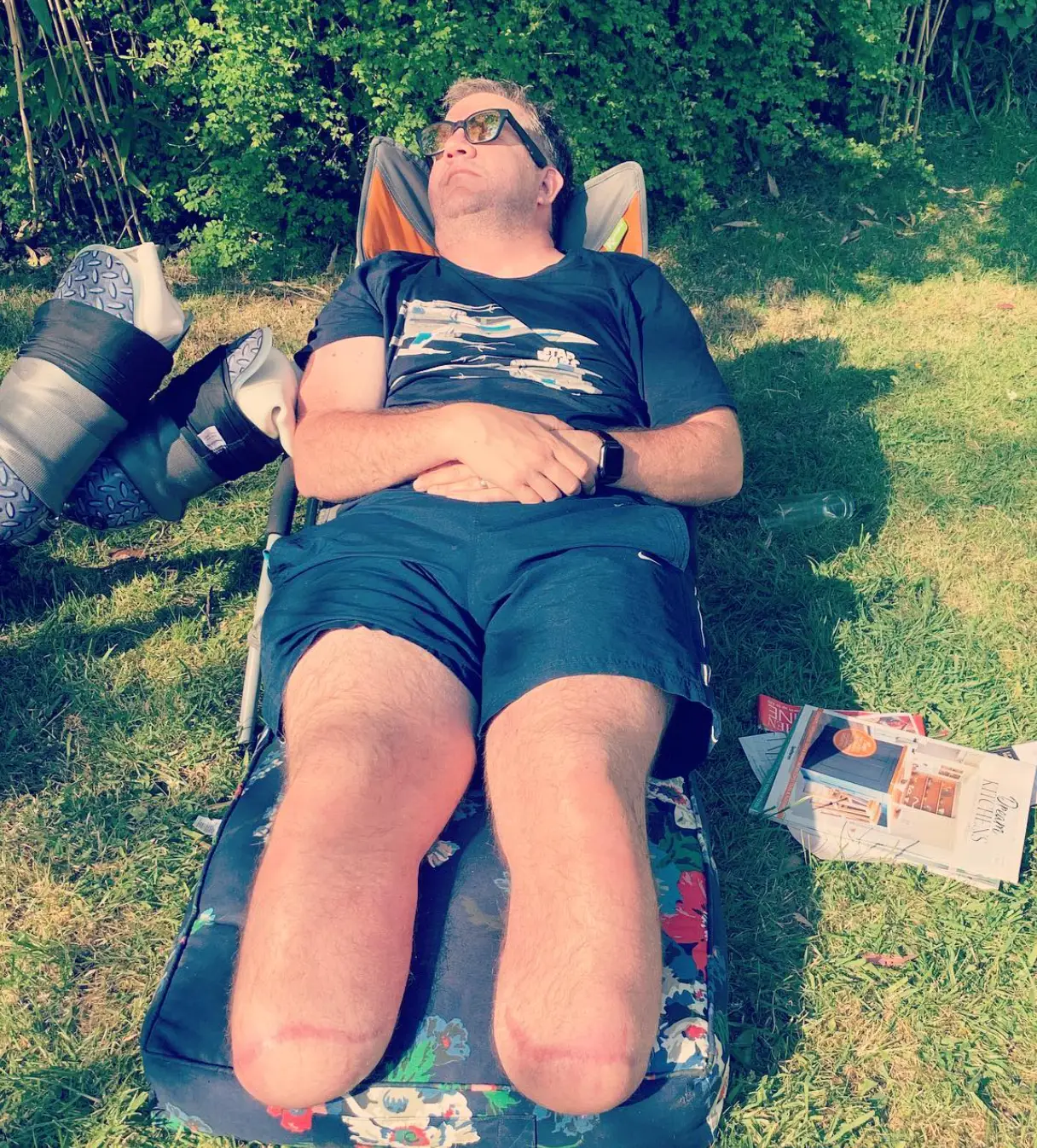 The former NHS surgeon had carried hundreds of amputations on others (bionicsurgeon/Instagram)