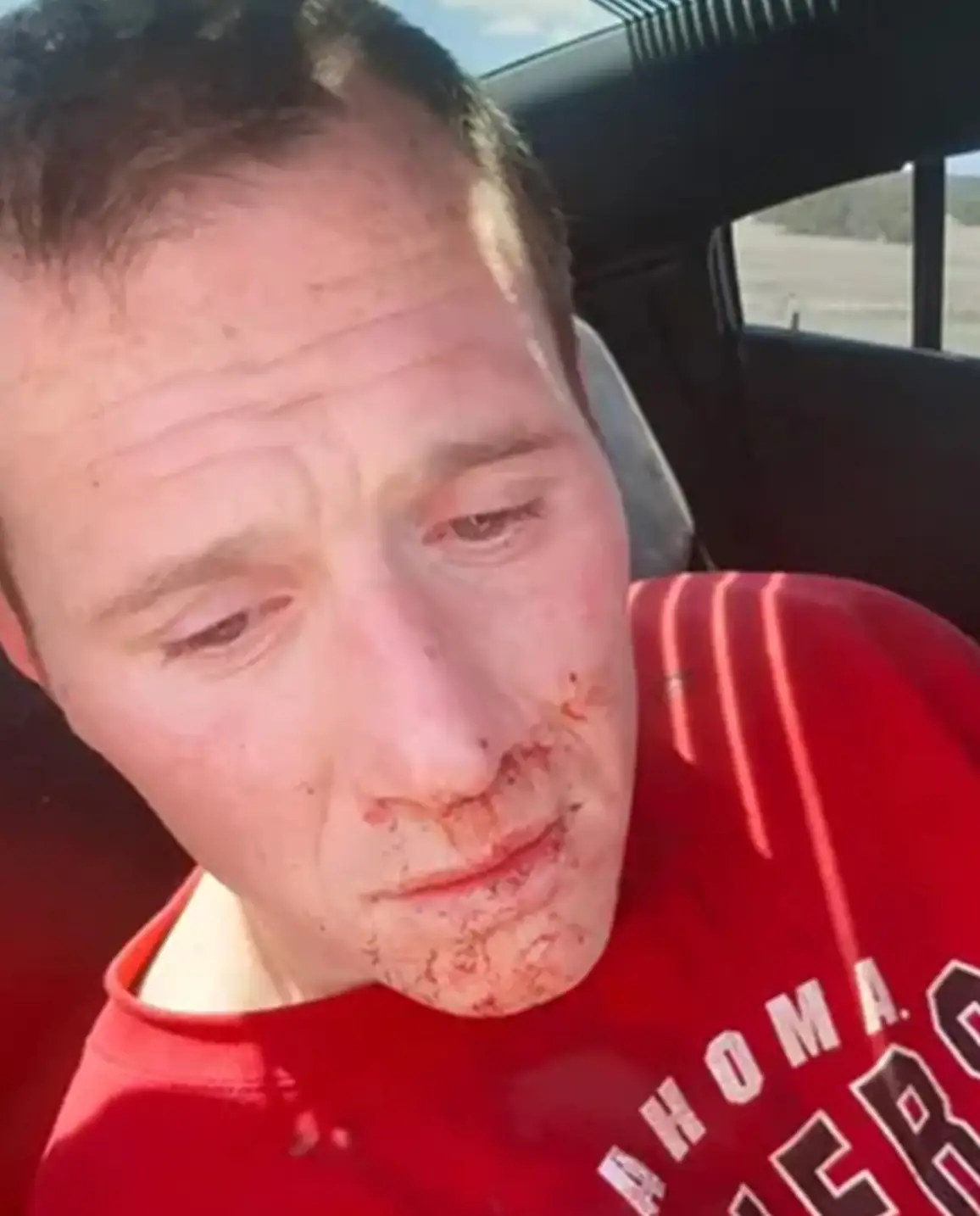 Her boyfriend Steven Tyler Stratton was also found with blood on his face after the alleged assault.