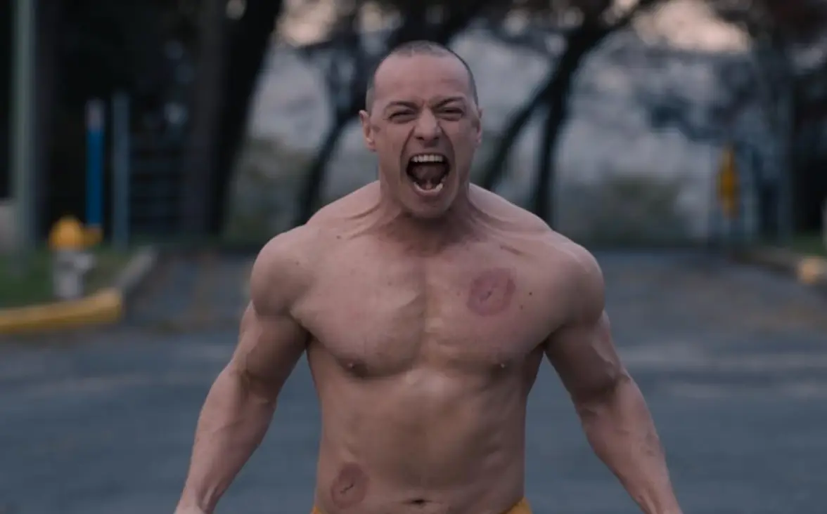 McAvoy's 'botched' medical experience took place not long before he started preparing for his role in 'Glass' (Universal Pictures)