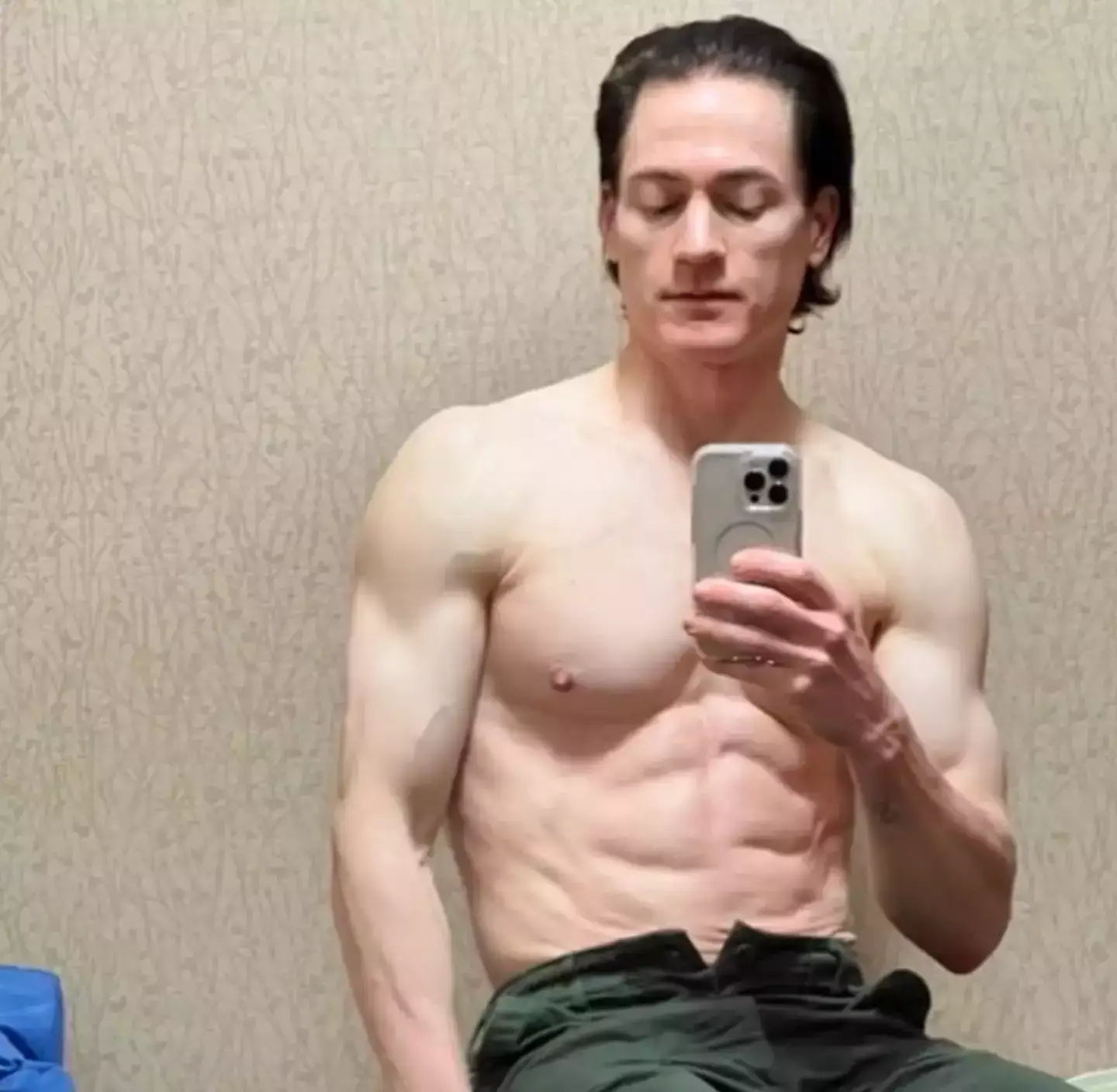 The biohacker admitted there were a lot of side effects with the drug (Instagram/@bryanjohnson_)