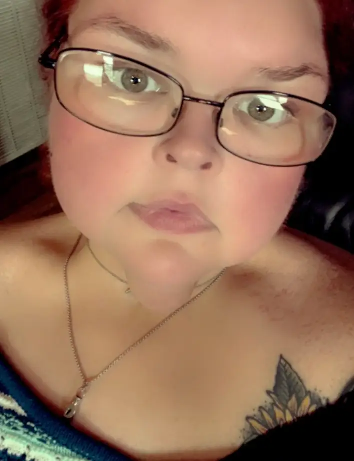 The photograph shows a significant difference in how Tammy's face now looks.