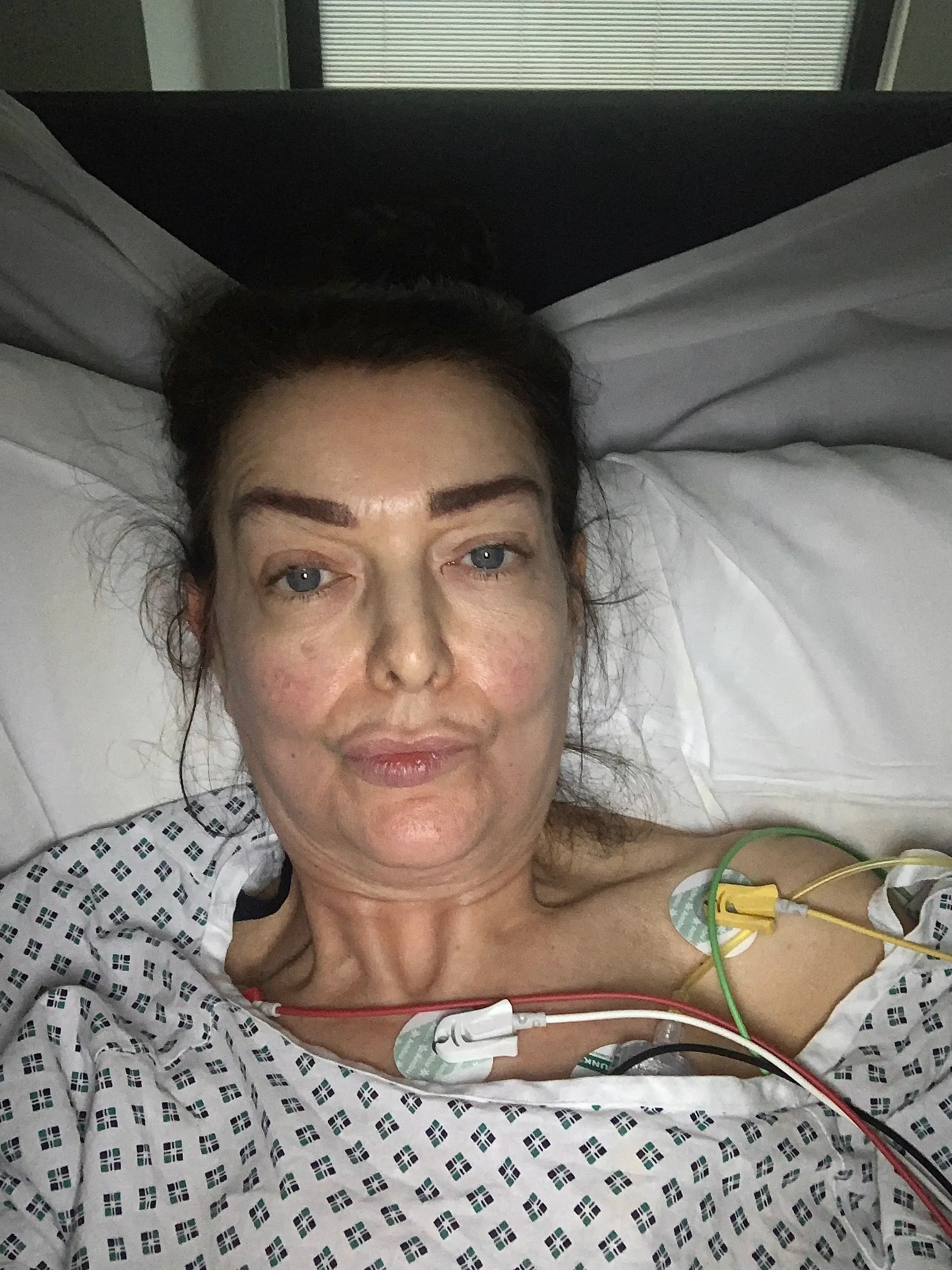 Natalie's key operation was delayed by a month (SWNS)