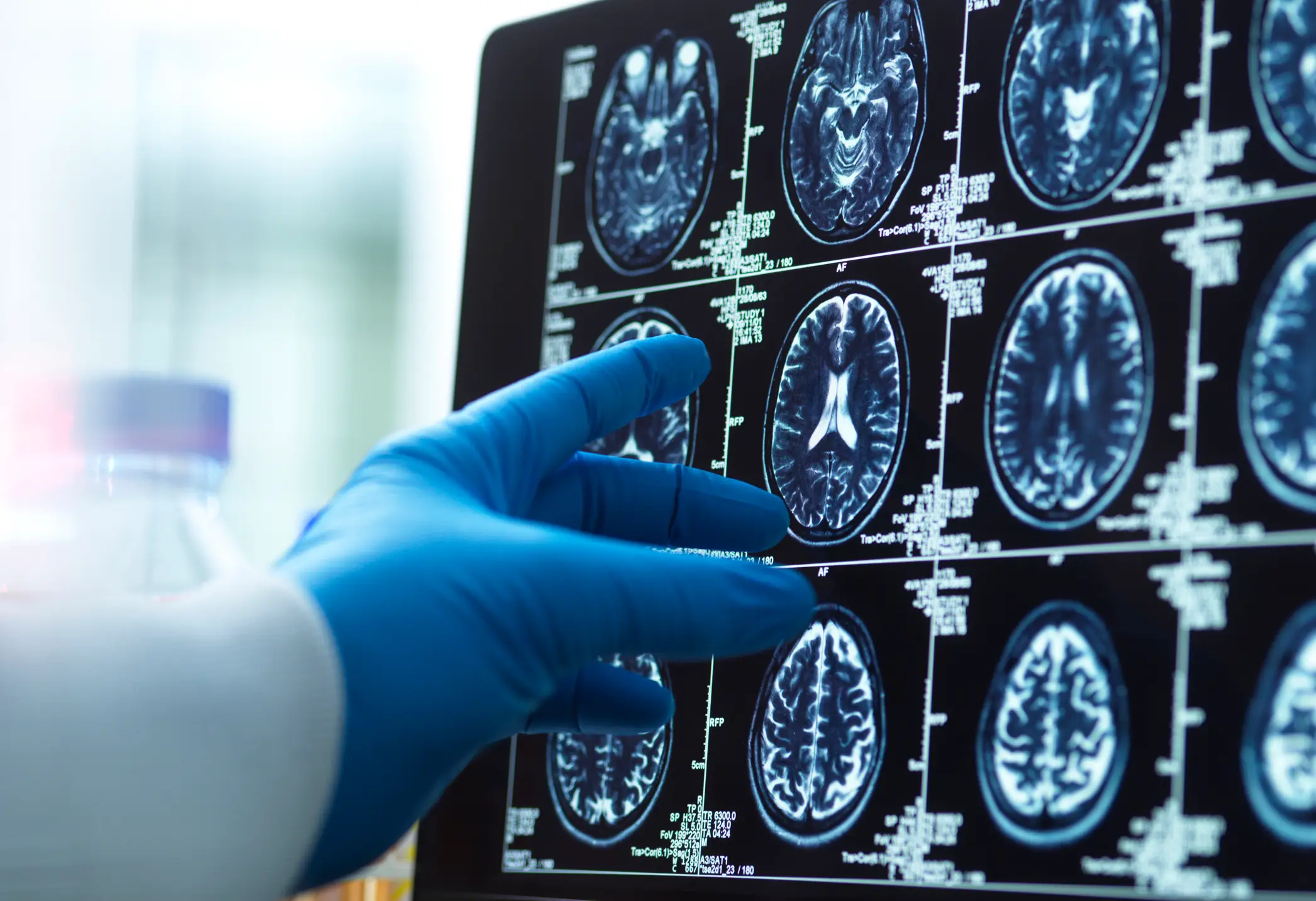 Attention span is the foundation for a number of brain operations (Getty Stock Image)