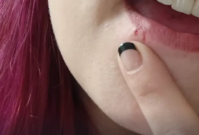 Jennica Church was diagnosed with herpes after eating the Arby's food order (2News Oklahoma)