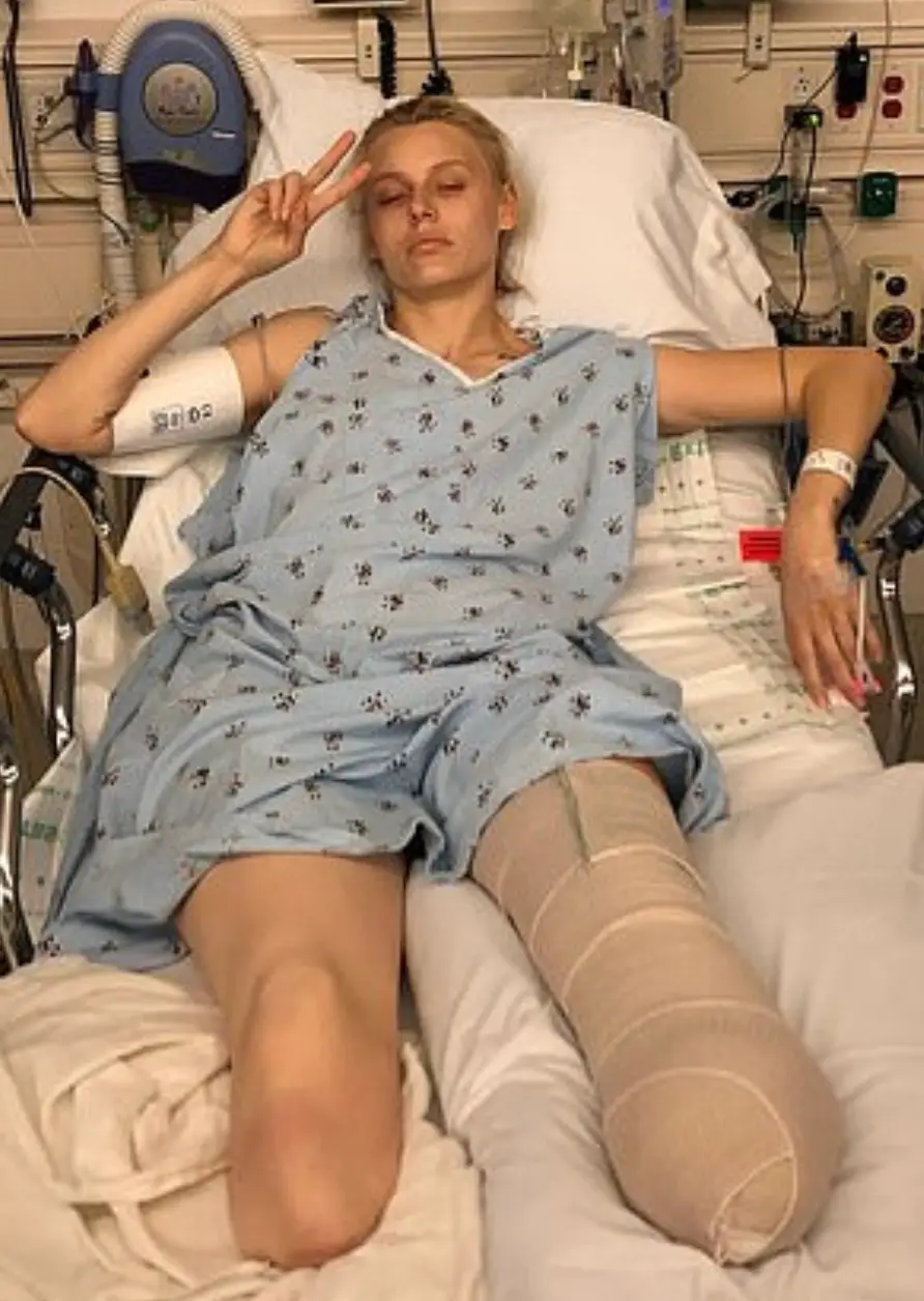 The woman has issued a warning to those who use tampons. (Instagram/@theimpossiblemuse)