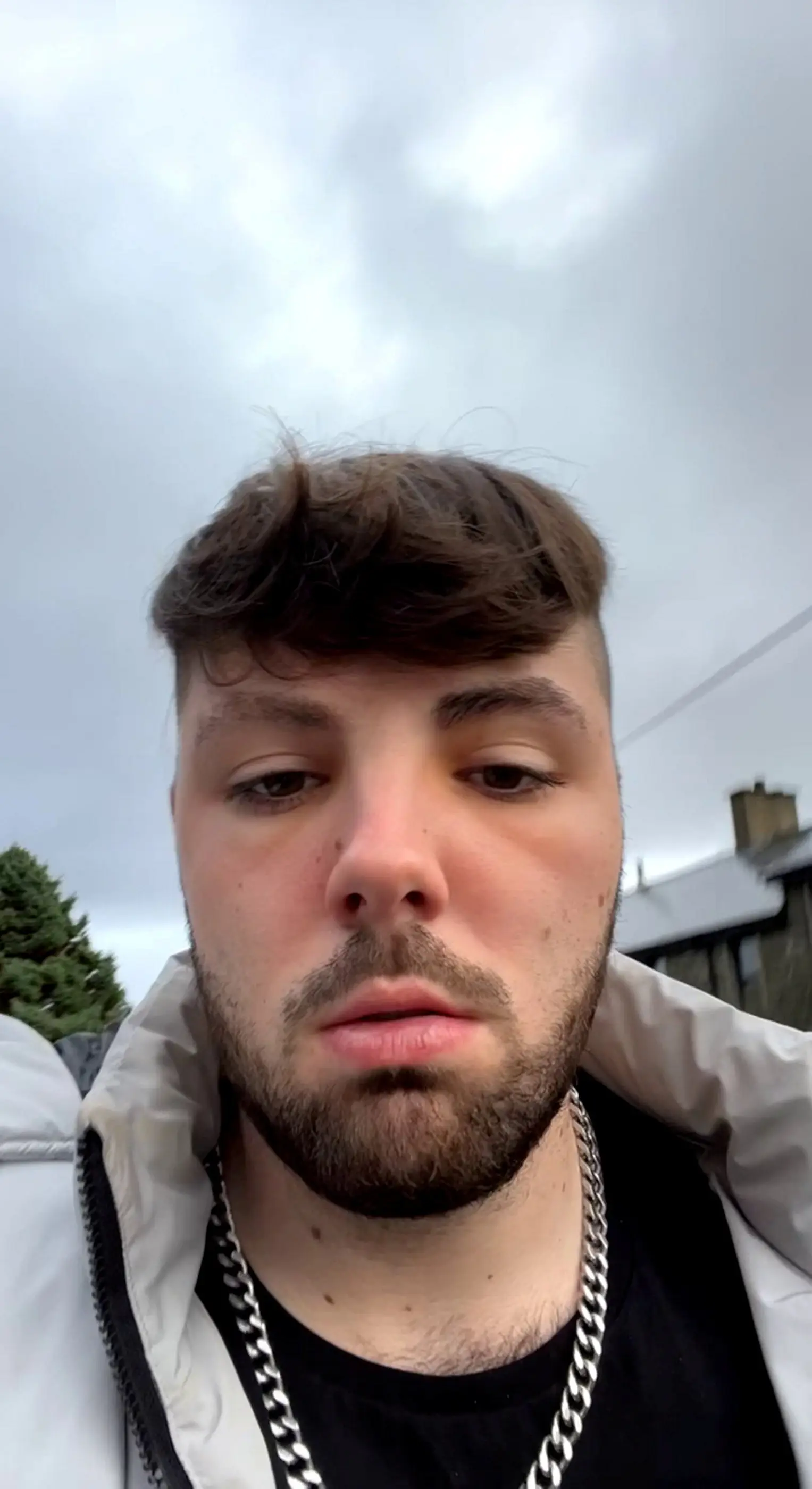 The influencer originally feared he'd contracted a sexually transmitted infection (SWNS)