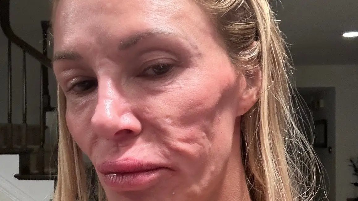 brandi glanville/x