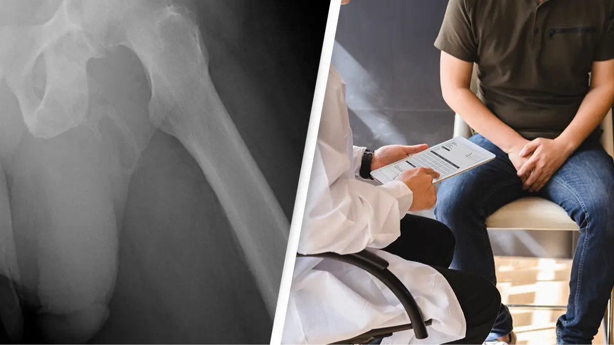 Doctors discover man's penis is turning into a literal bone due to 'rare condition'