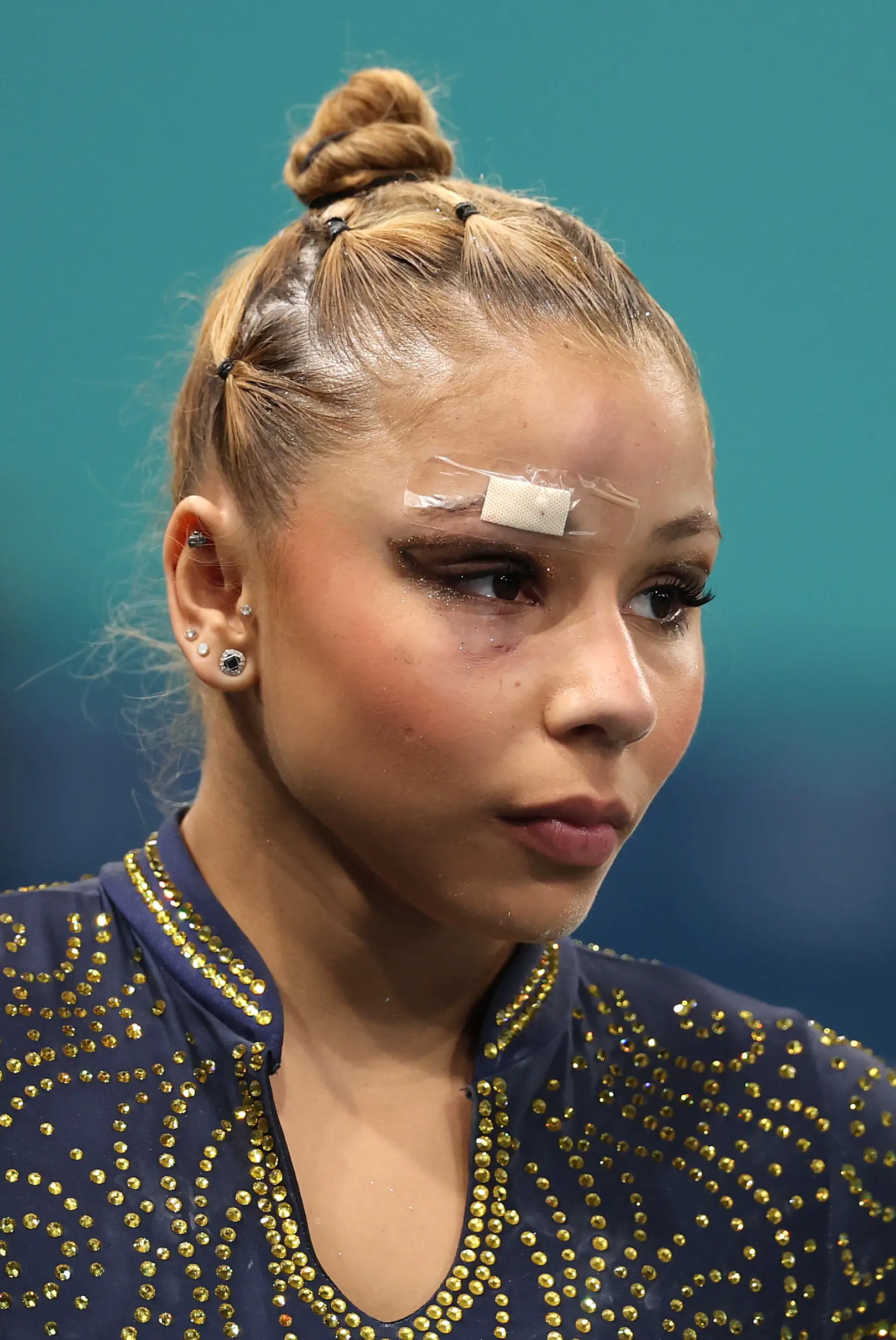 The Brazilian gymnast sustained an injury while practicing. (Jamie Squire/Getty Images)