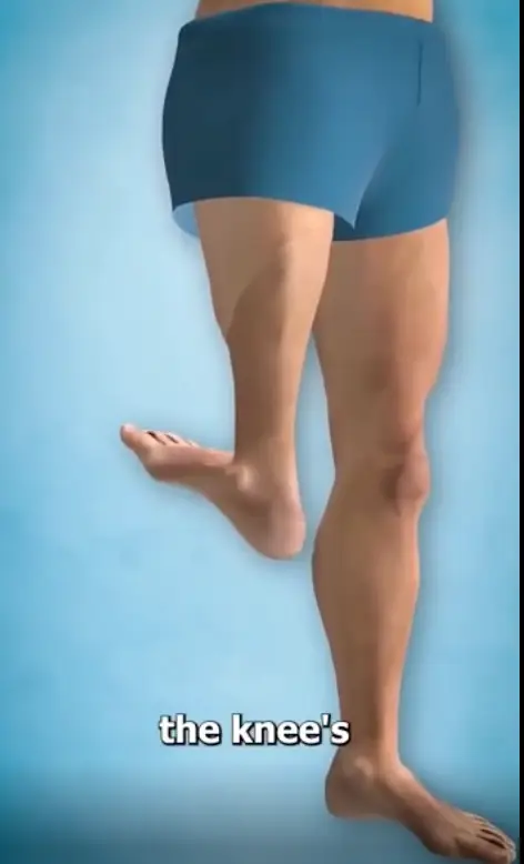 People are in awe of how the leg is rotated round.