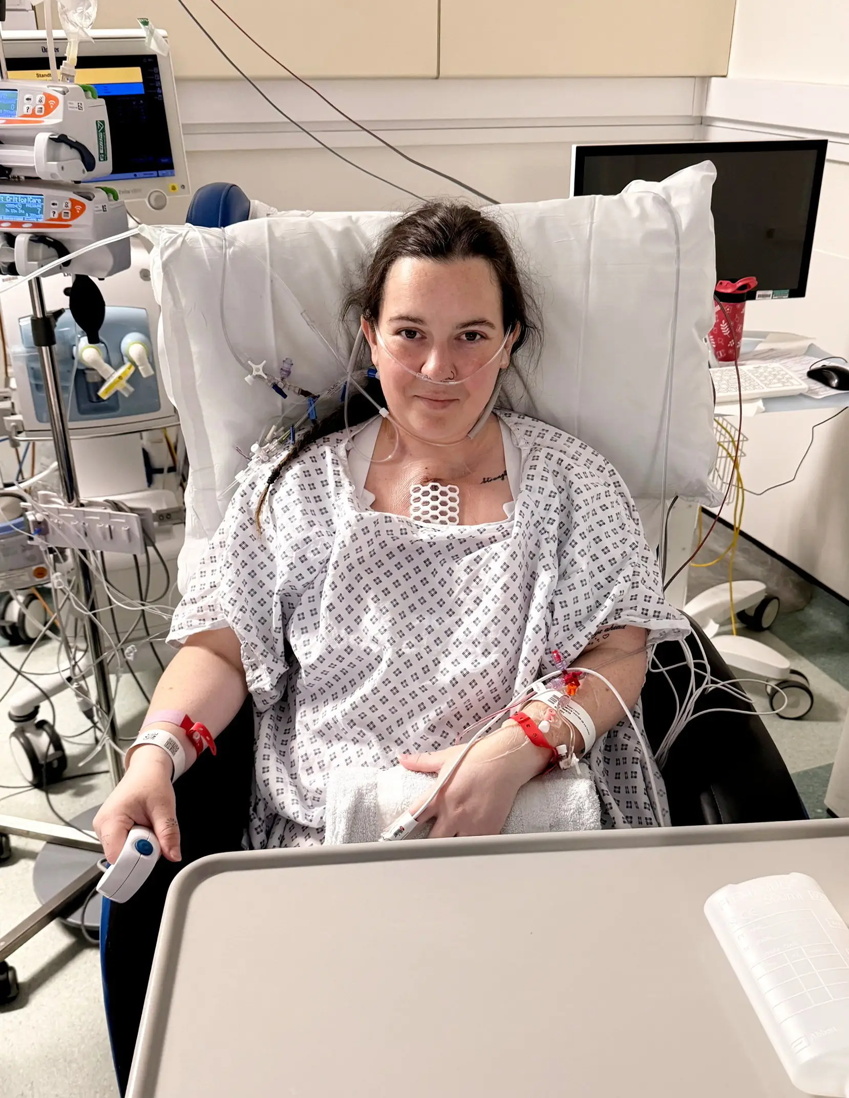 The 36-year-old has Ebstein’s anomaly (SWNS)