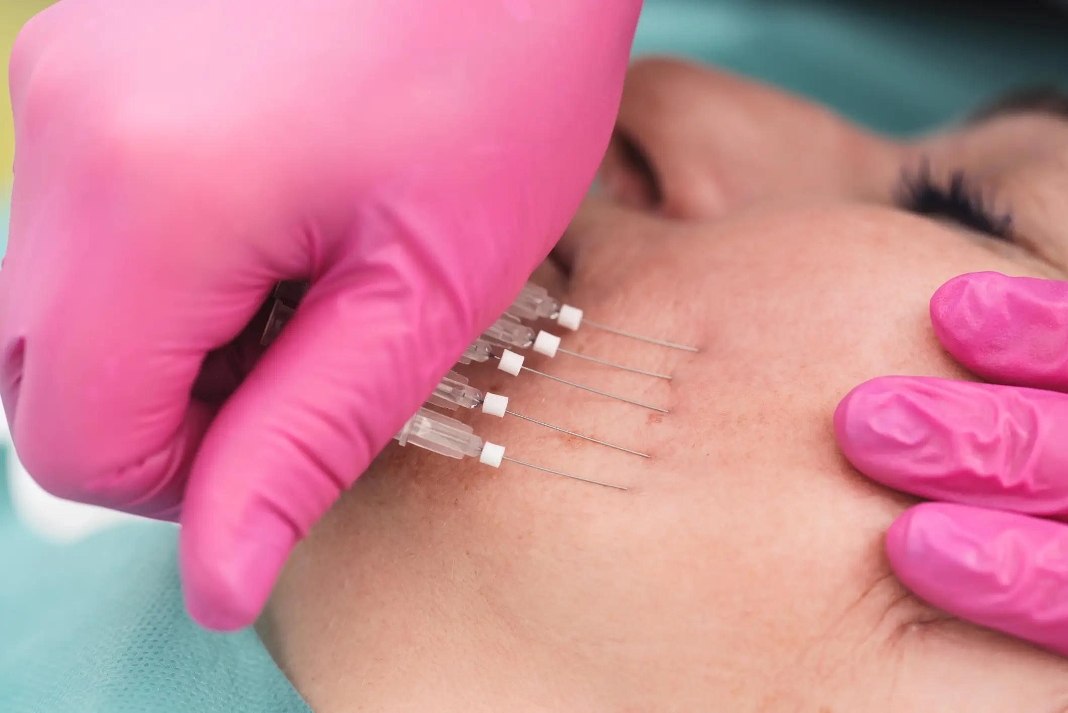 Threads involve temporary results (Getty Stock Images)