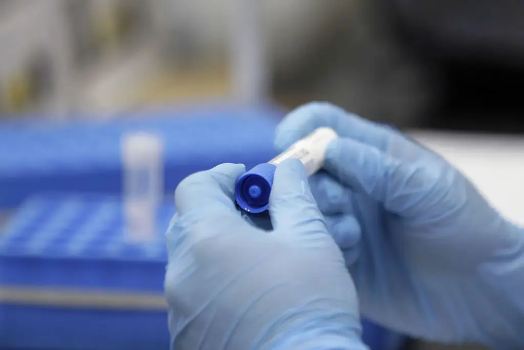 23andMe has said it will be 'transparent' about data (Kiyoshi Ota/Bloomberg via Getty Images)