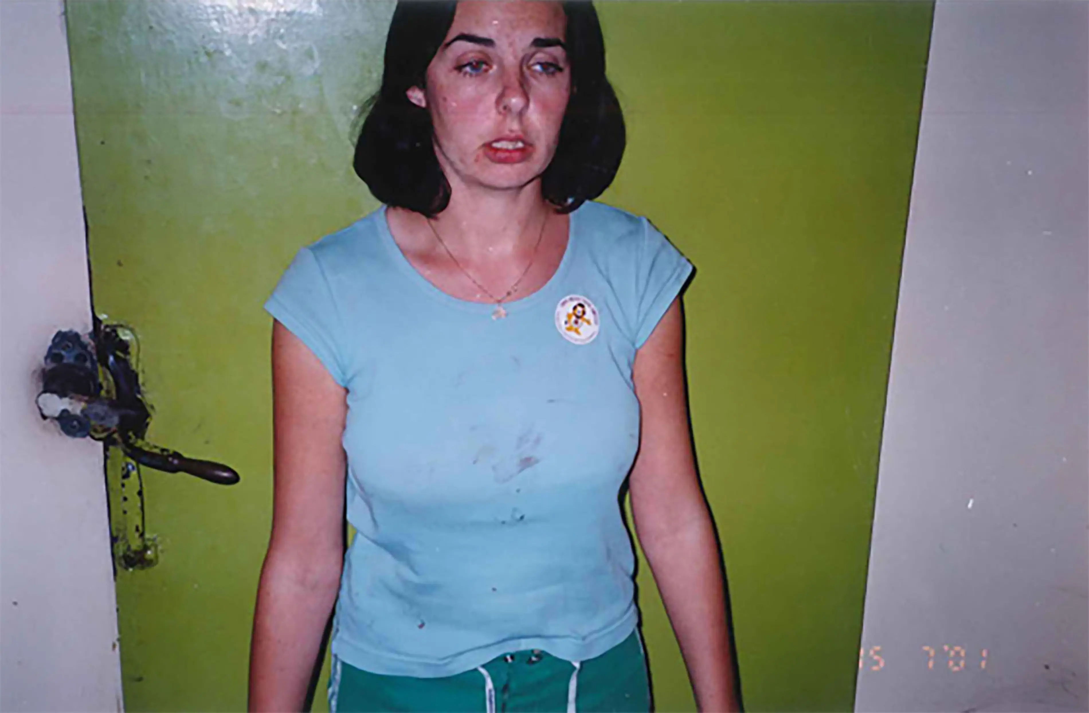 Northern Territory police released images including a photograph of a 'stunned-looking' Lees taken in the hours after she narrowly escaped Murdoch. (Northen Territory police)