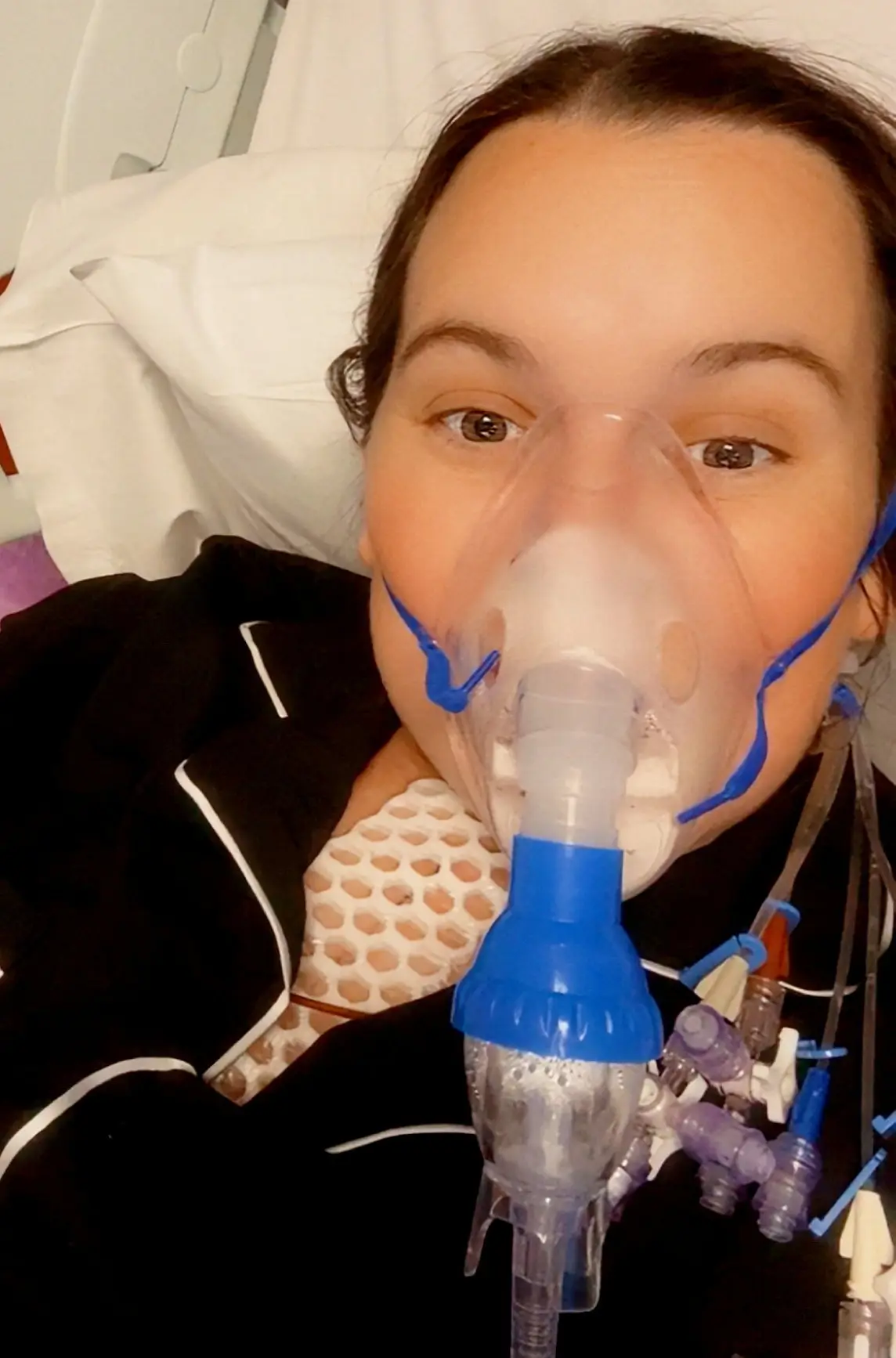 Abigail had to go to her doctors several times over several years before being correctly diagnosed (SWNS)