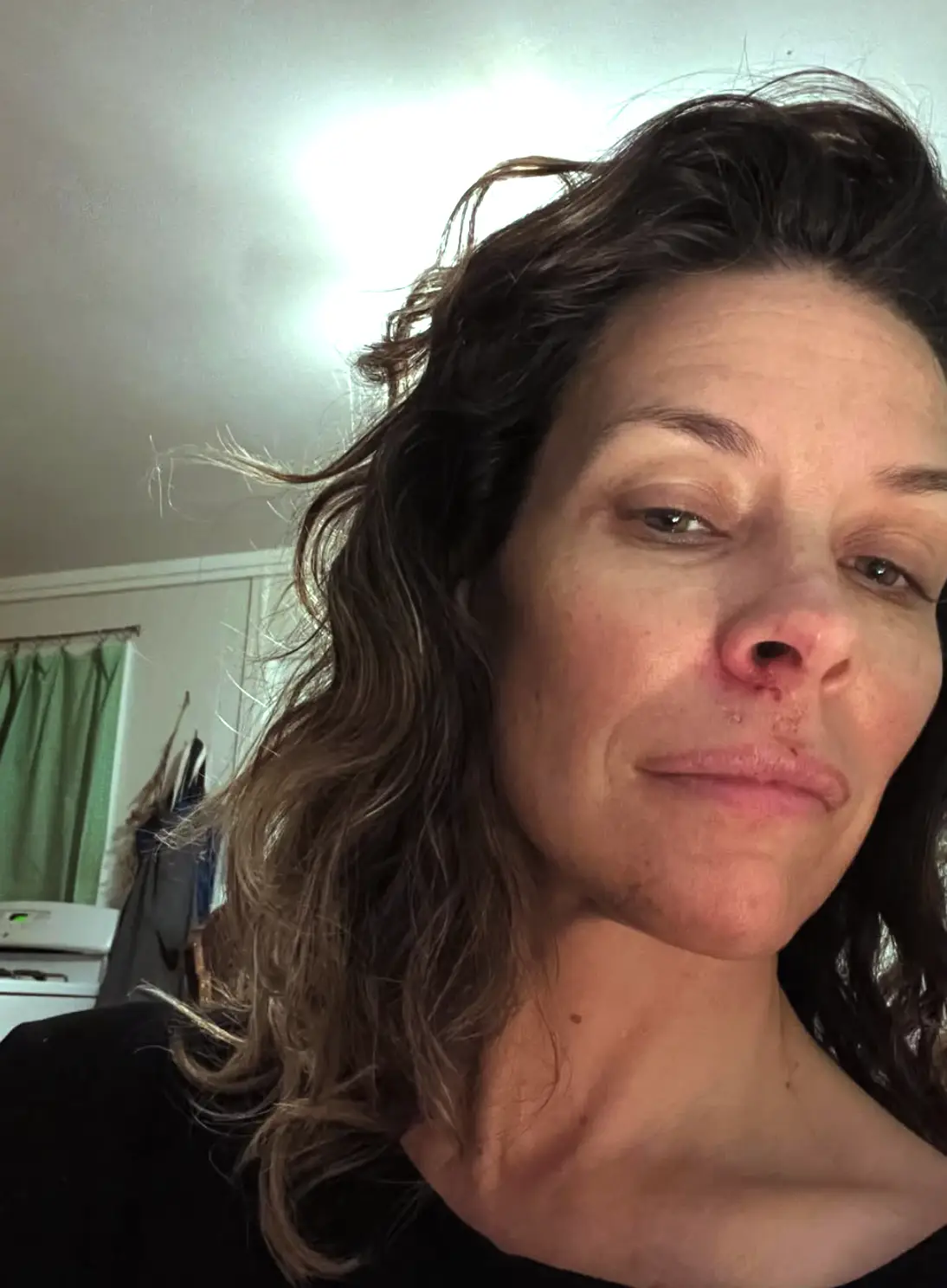 Evangeline Lilly suffered the injury after blacking out at the beach in May 2025 (evangelinelillyofficial/instagram)
