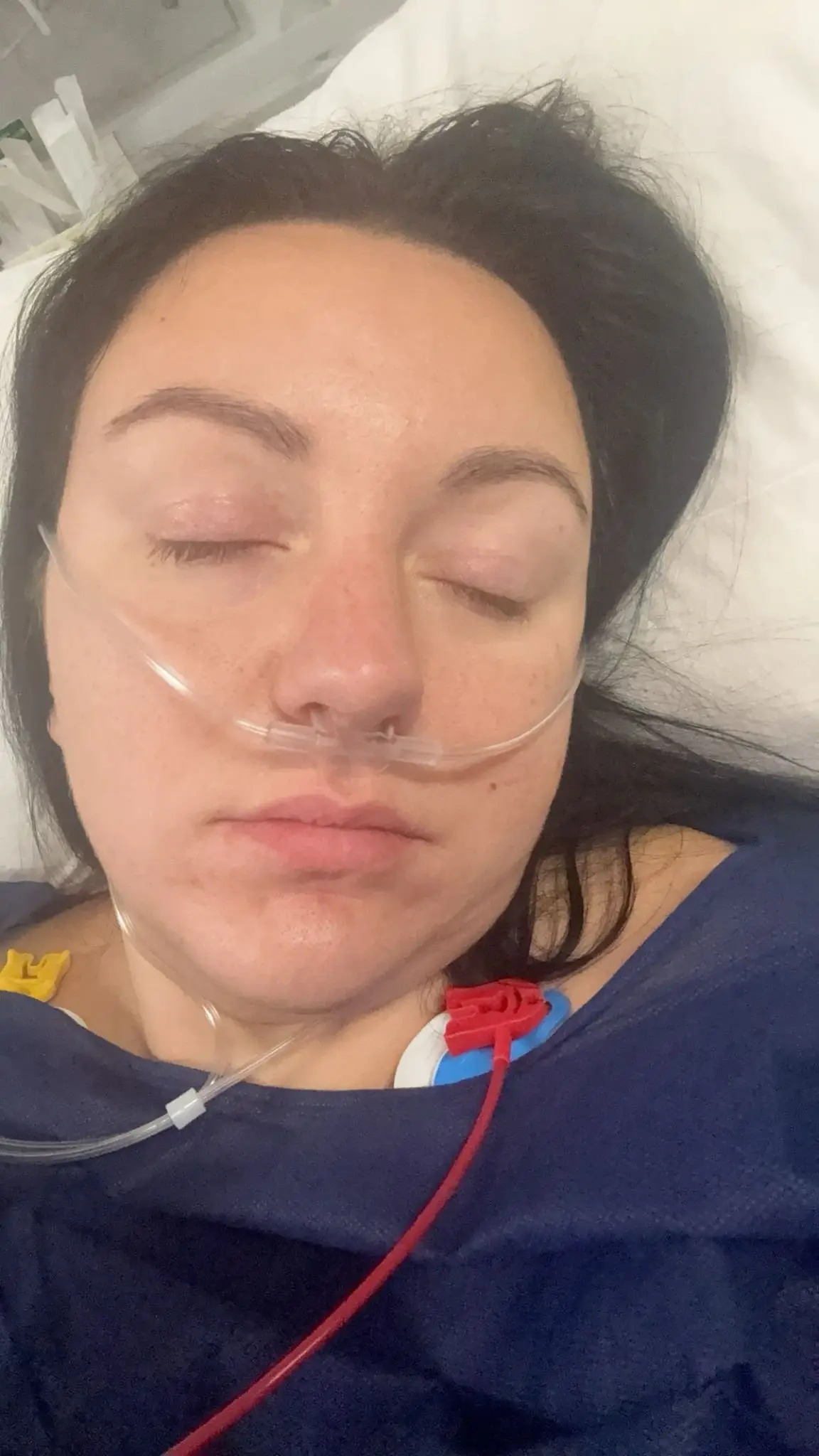 Sarah-Jayne Crawford ended up in hospital after falling unwell while taking Wegovy (SWNS)
