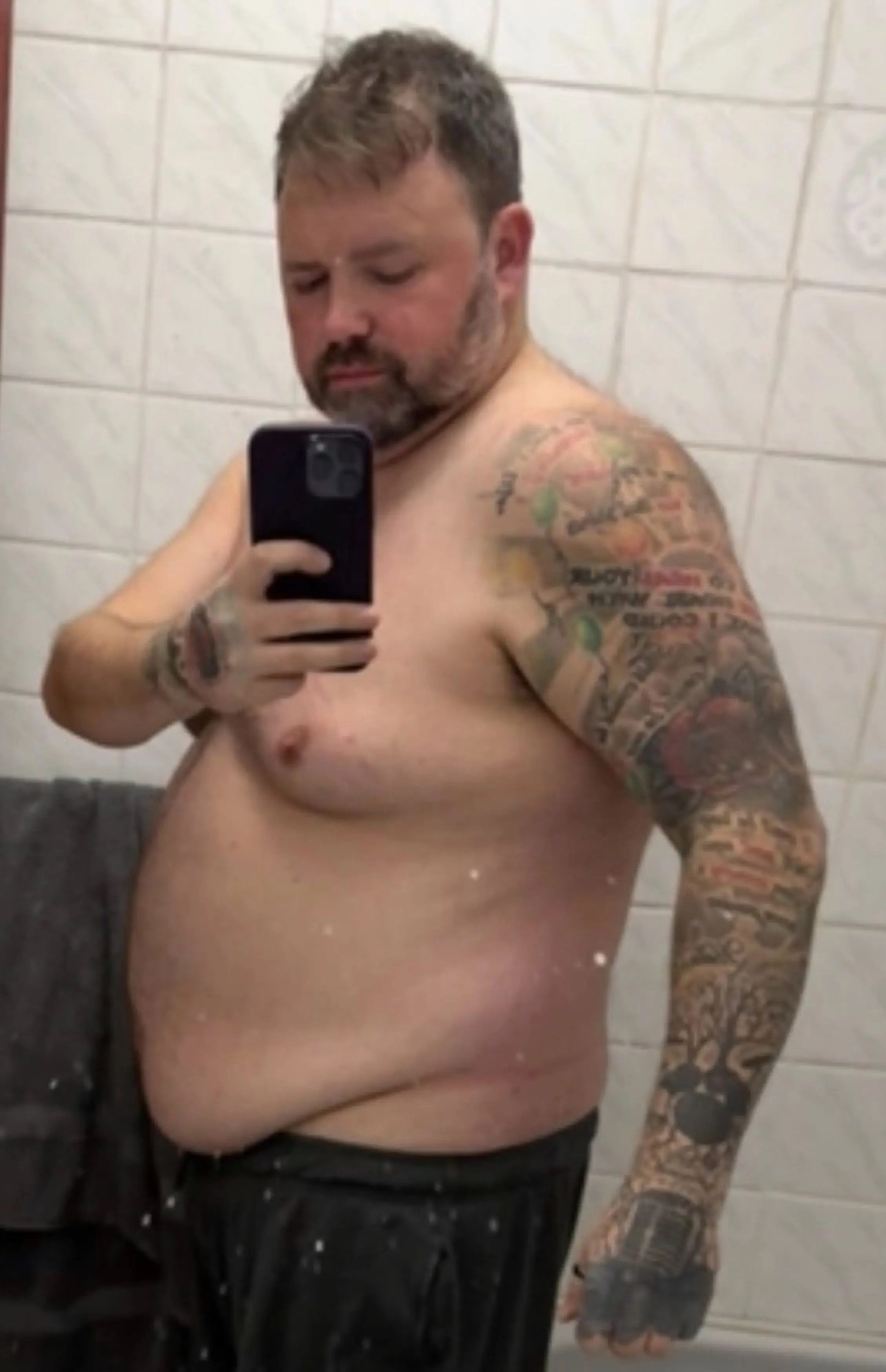 Edd weighed more than 280lb before taking GLP-1s (Kennedy News)