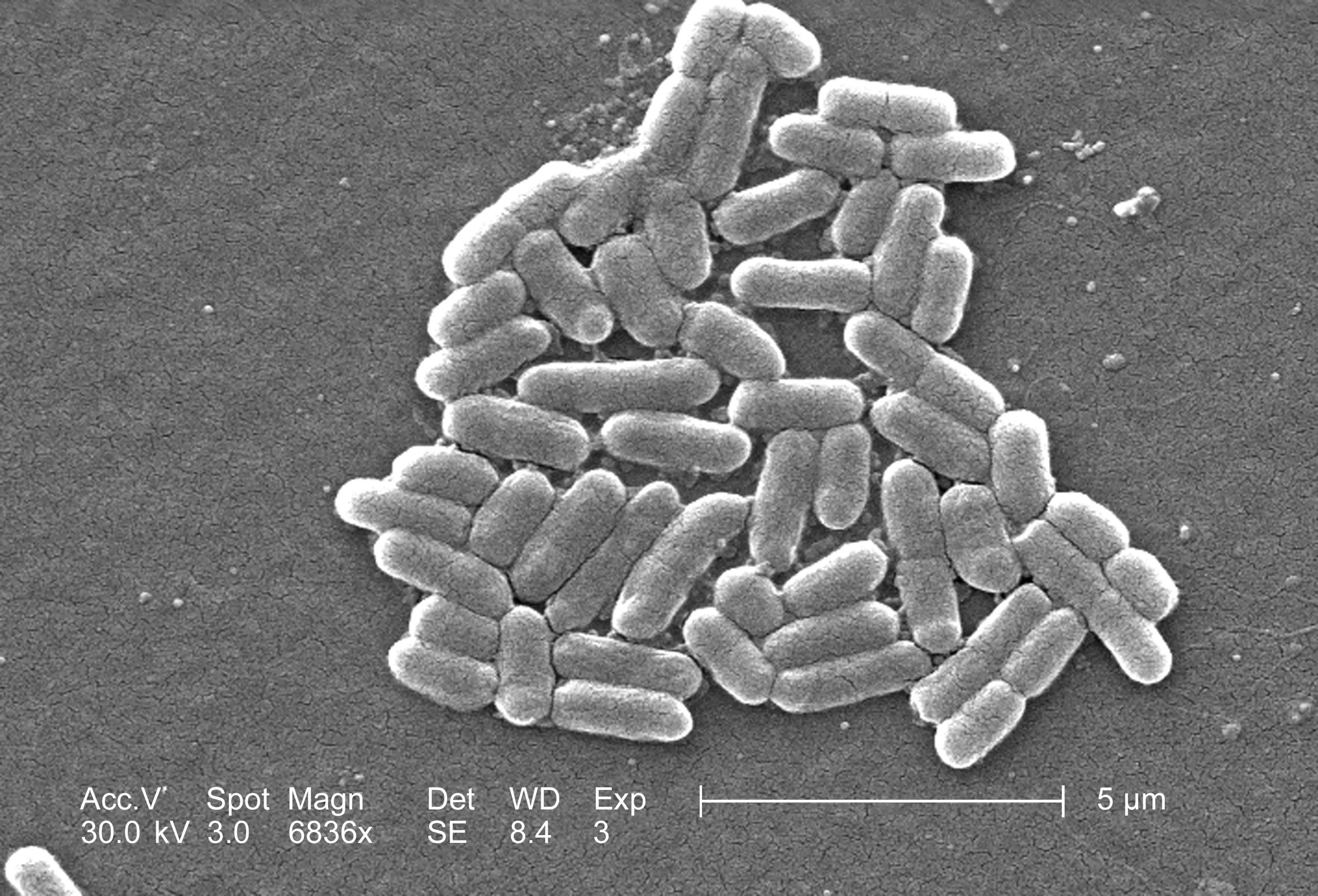 E.coli infections can be fatal (CDC/Smith Collection/Gado/Getty Images)
