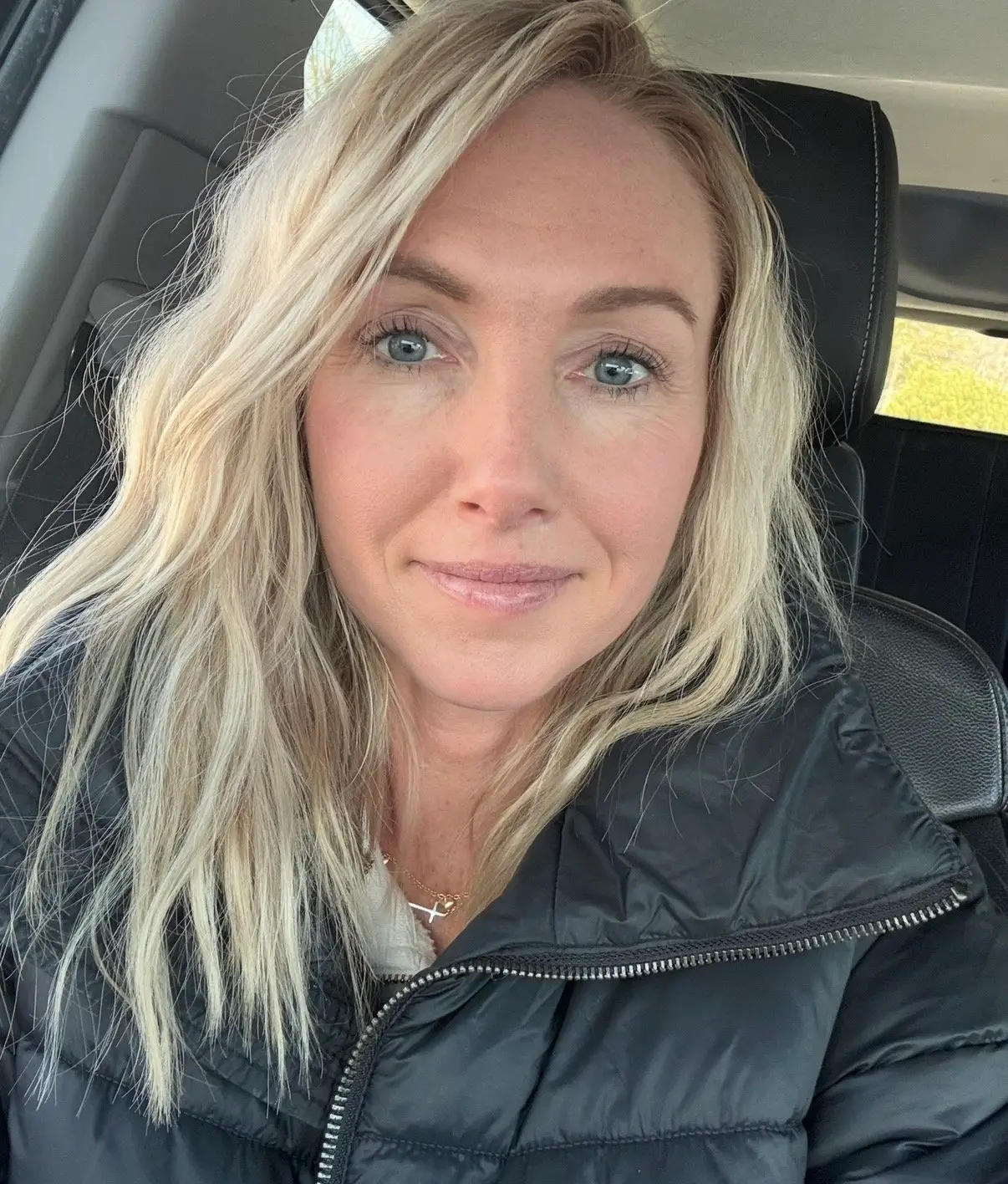 Jen is now encouraging others to think twice about getting Botox (SWNS)