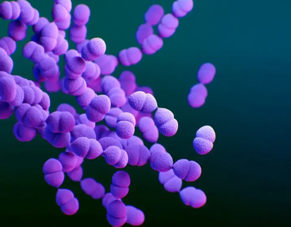 Meningitis in the US is most commonly caused by viral infections, followed by bacterial infections (Meredith Newlove/Science Photo Library/Getty Images)