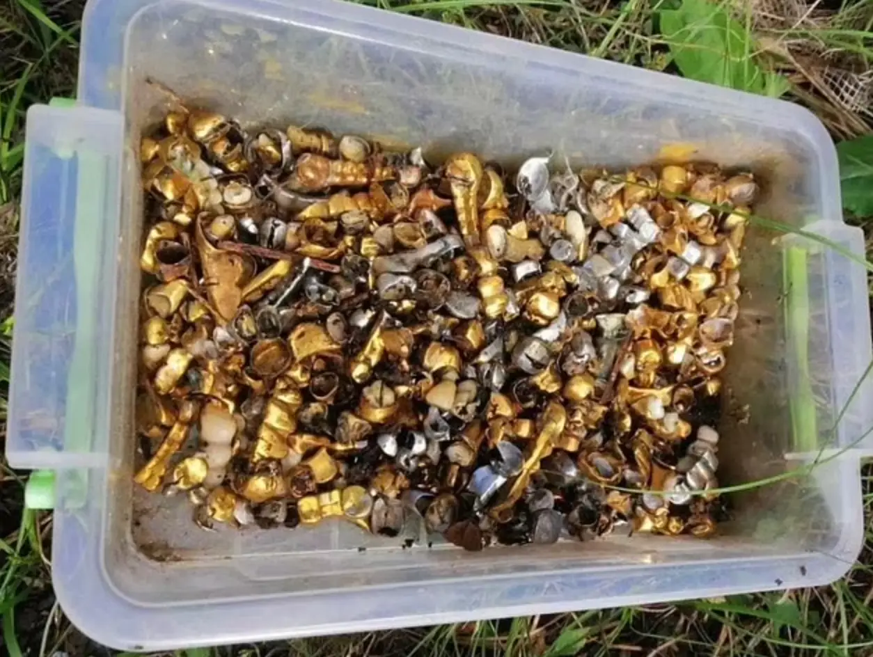 Russian soldiers removed teeth from Ukrainians as a form of torture.