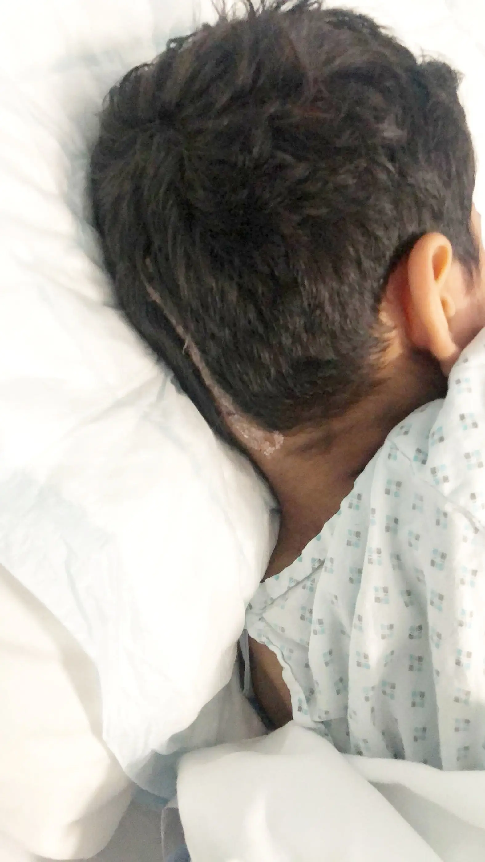 It all started with tiredness and headaches (SWNS)