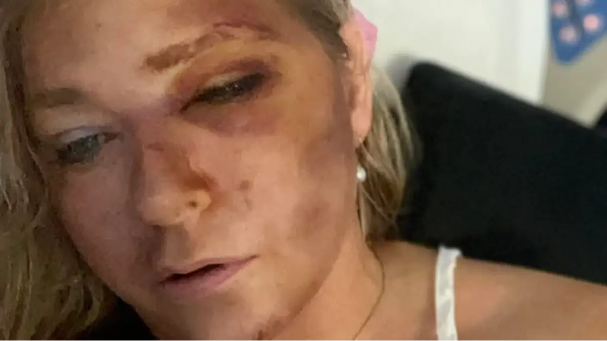 Jeffrey Epstein accuser Virginia Giuffre released from hospital a week after saying she has 'days left to live'