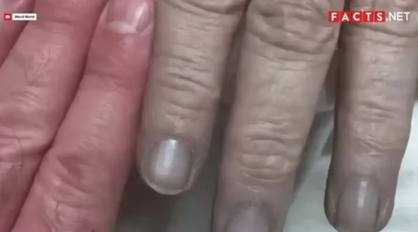 The family were blue (YouTube)