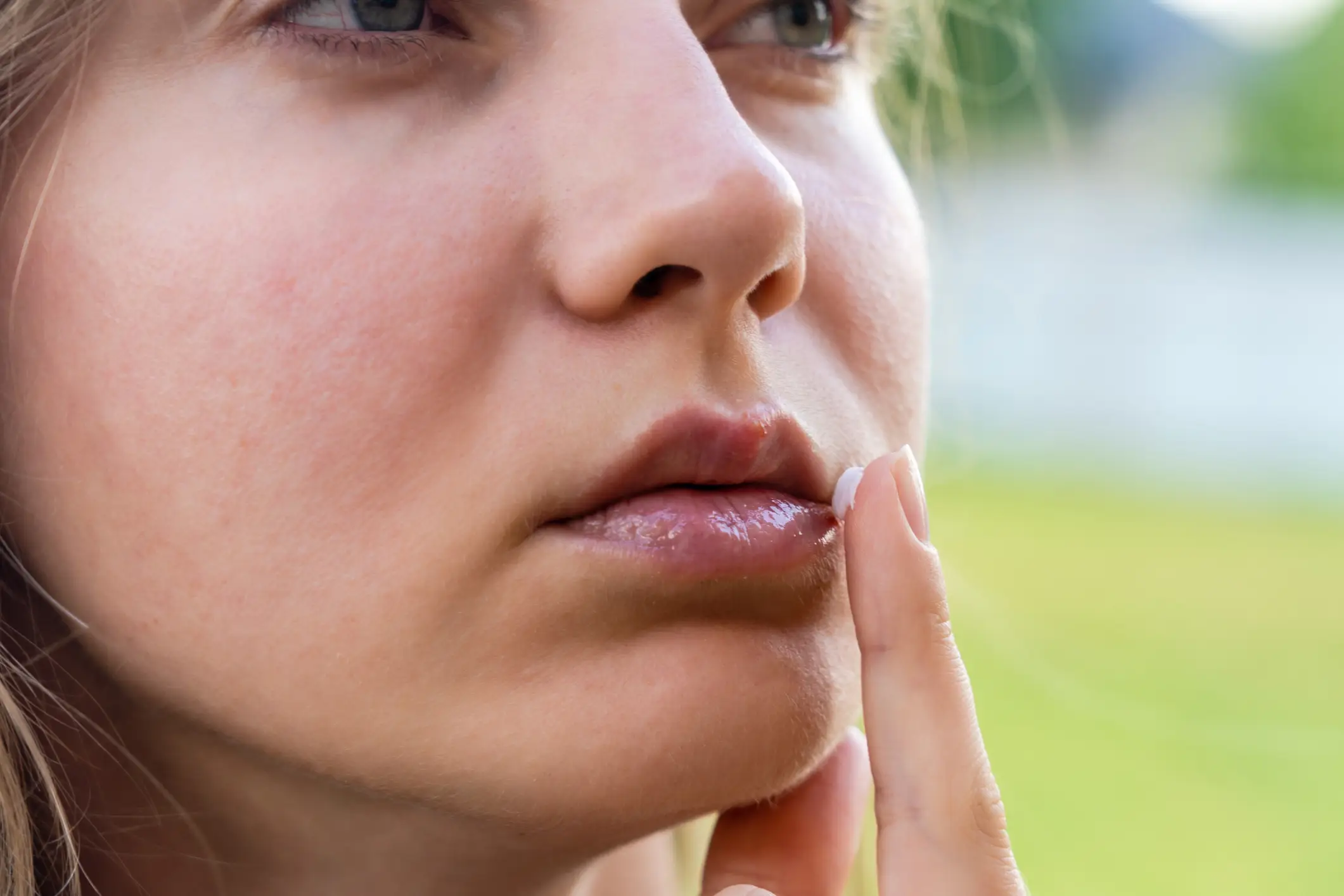 Persistent chapped lips could be a skin cancer symptom (Getty Stock Image)