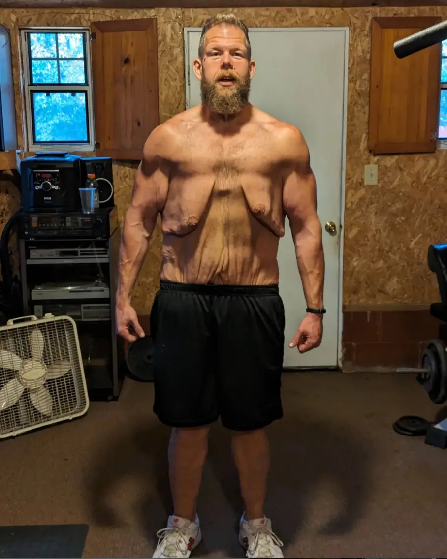 “I needed to show everybody all the skin I have and how far I’ve come and just embrace it.” (Instagram/ @3to1fitness)