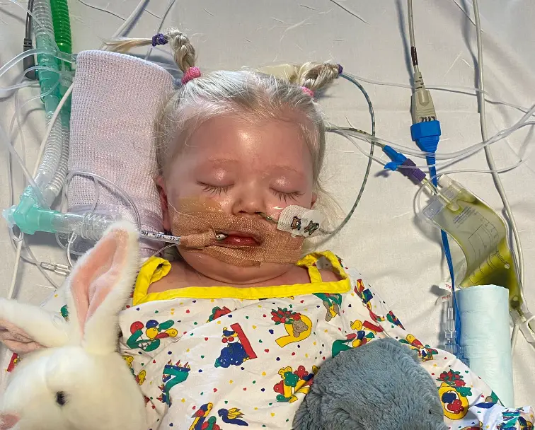 Tavie has undergone 14 operations in her short life. (Supplied)