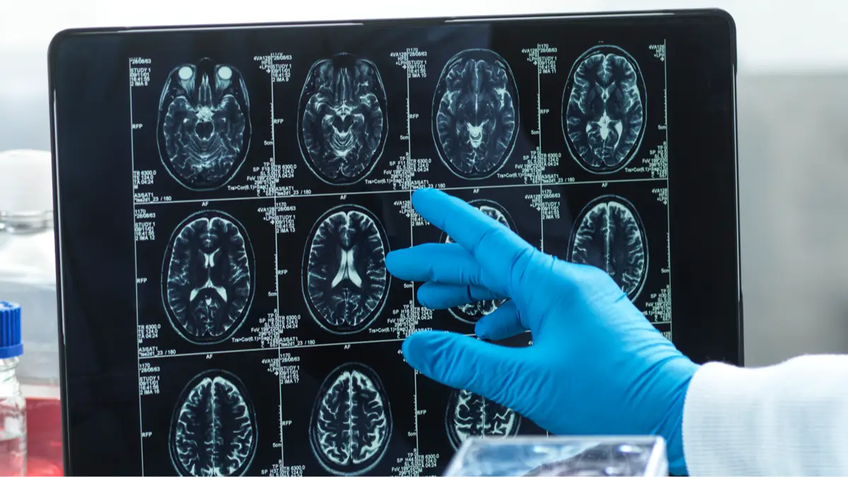 Getty Images/TEK IMAGE/SCIENCE PHOTO LIBRARY