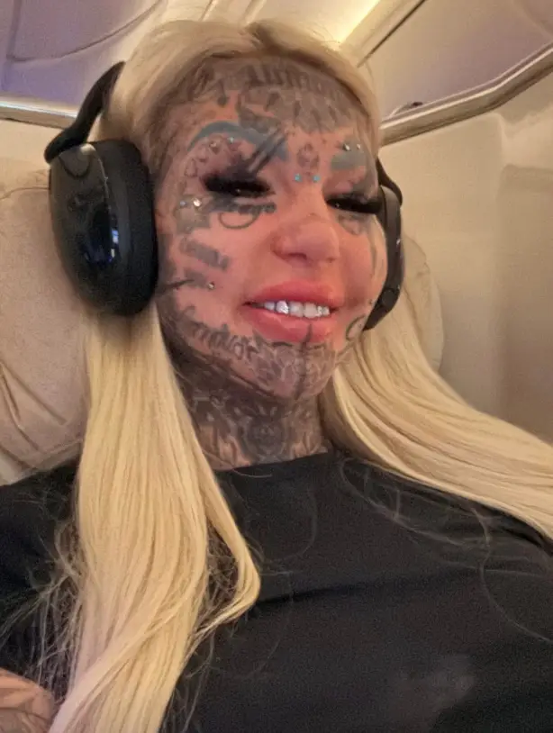 The influencer is undergoing two procedures while in Spain. (@amberluke.666/Instagram)