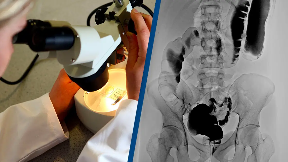 Study Finds New Cancer Treatment Could Shrink Deadly Cells By 50%