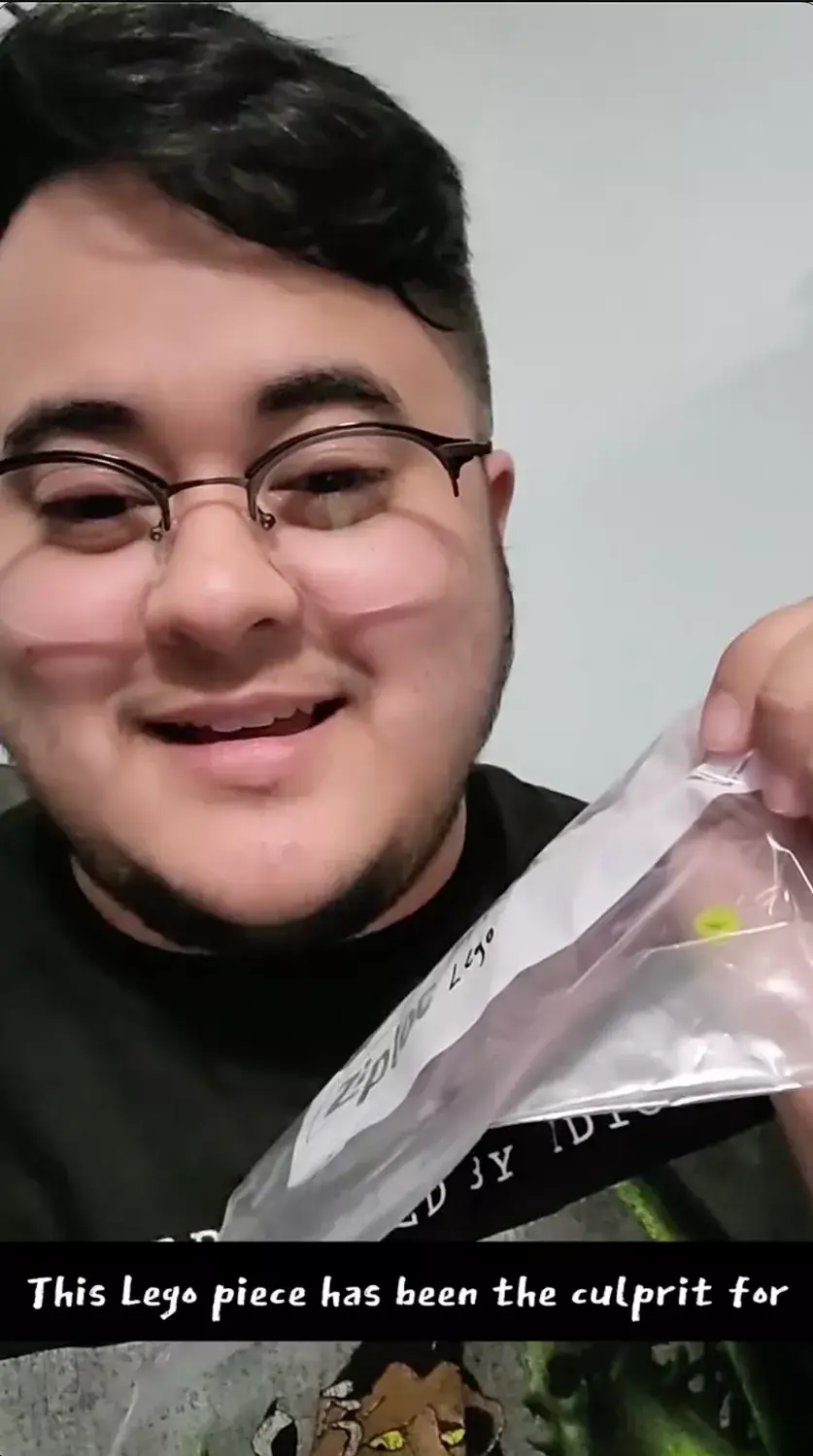 Andi showed off the tiny toy that became dislodged from their nose (Instagram/@bigoompalumpia)