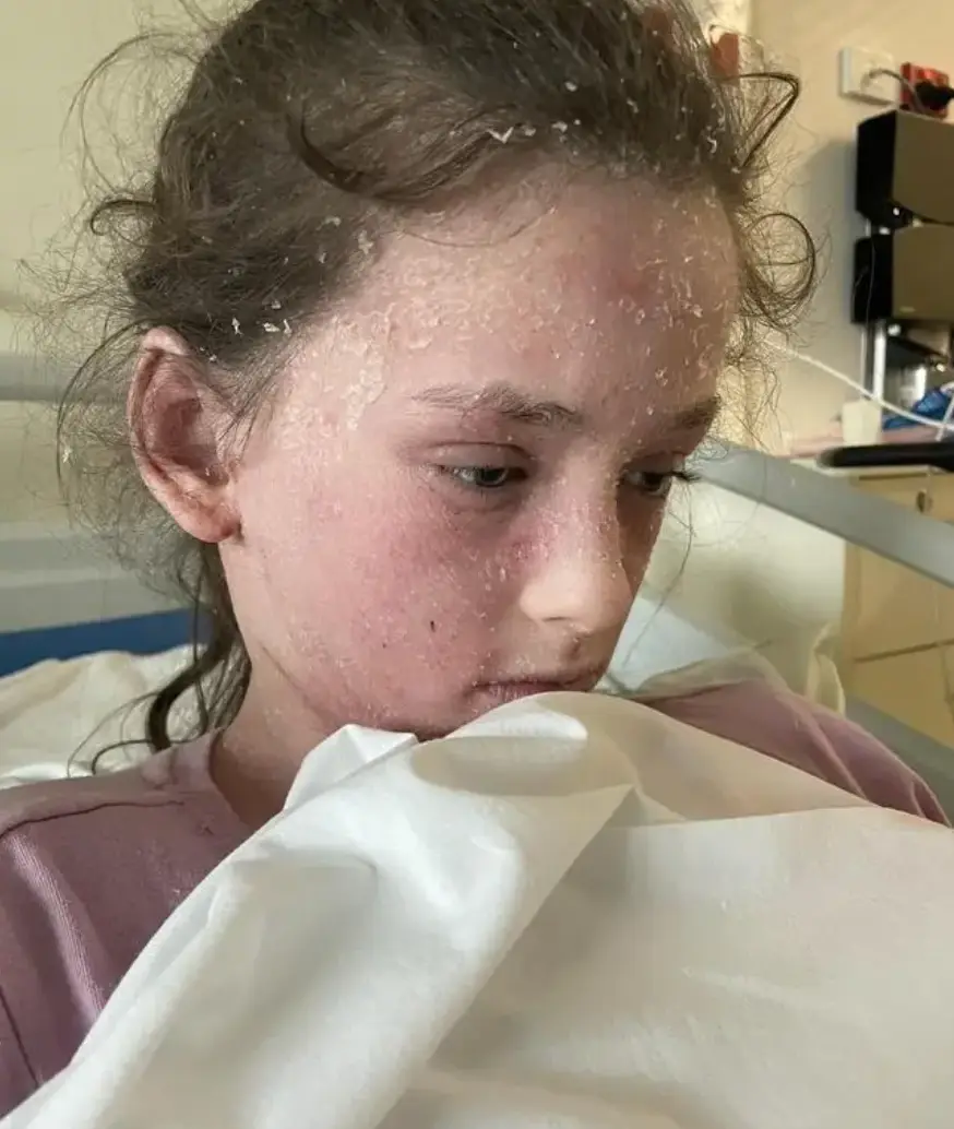 The dancer suffers from rare condition.