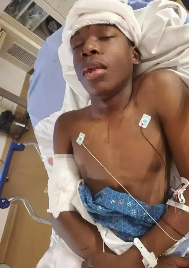 Ralph was shot twice after he rang the wrong doorbell.