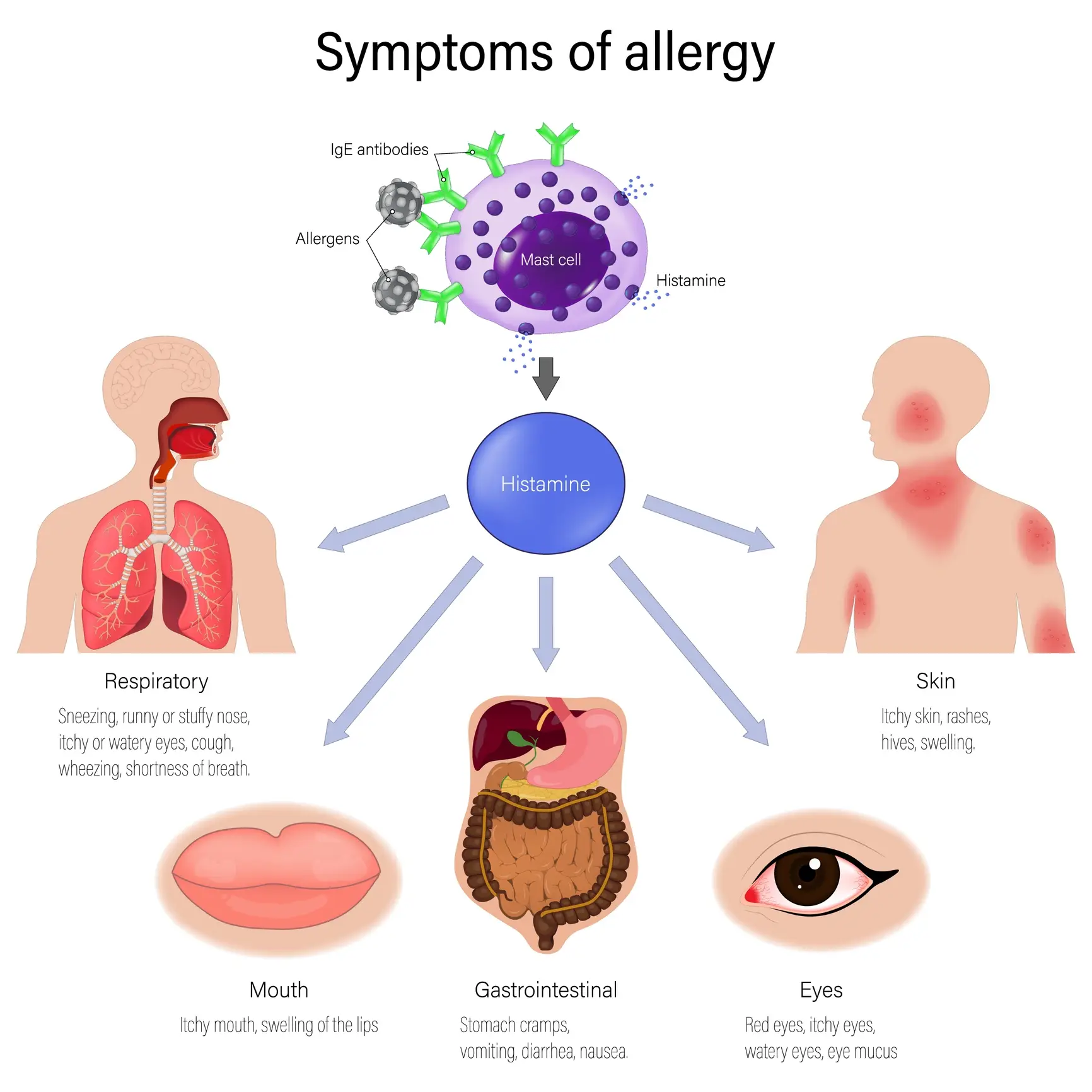 An allergic reaction happens when your immune system overreacts to a normally harmless substance, called an allergen (Rujirat Boonyong)