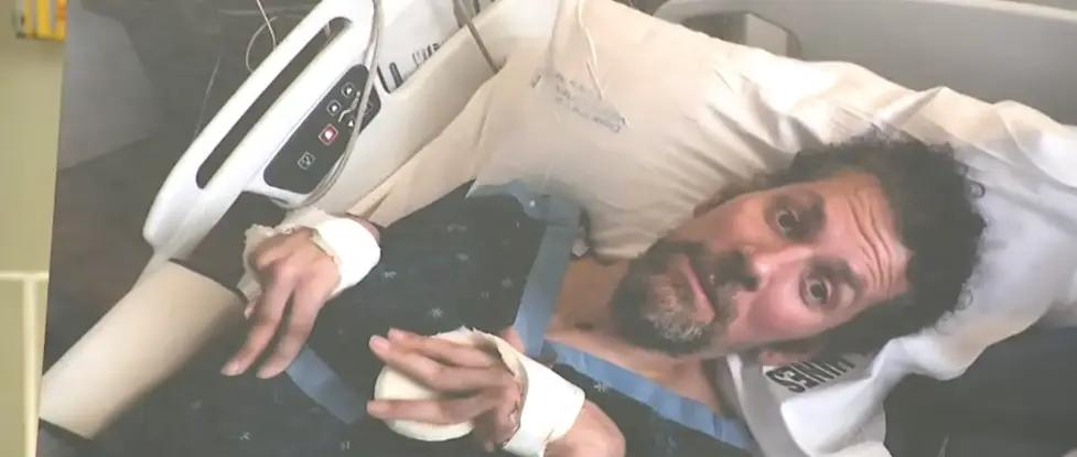 Joe Belgio remains in hospital (CBS Chicago)