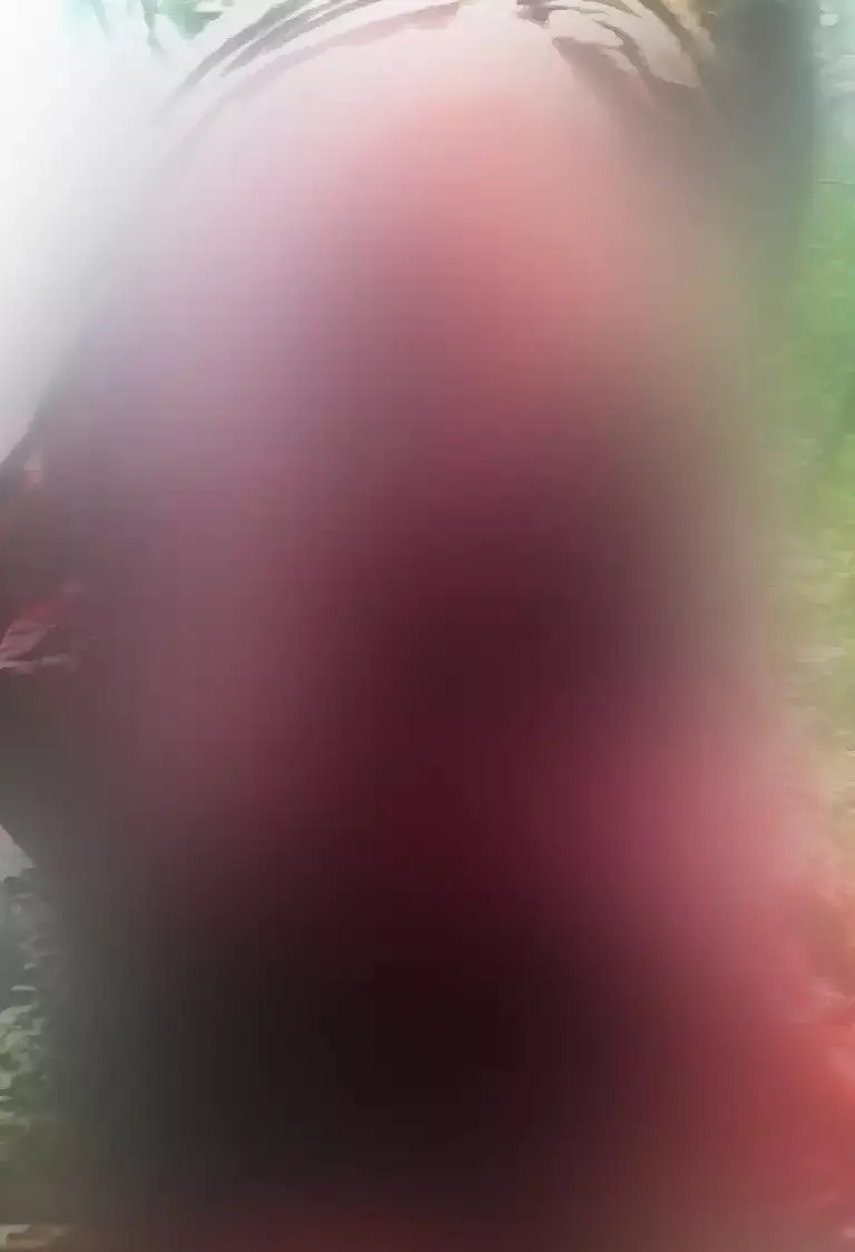 Jeremy's face was entirely ripped away by the bear.