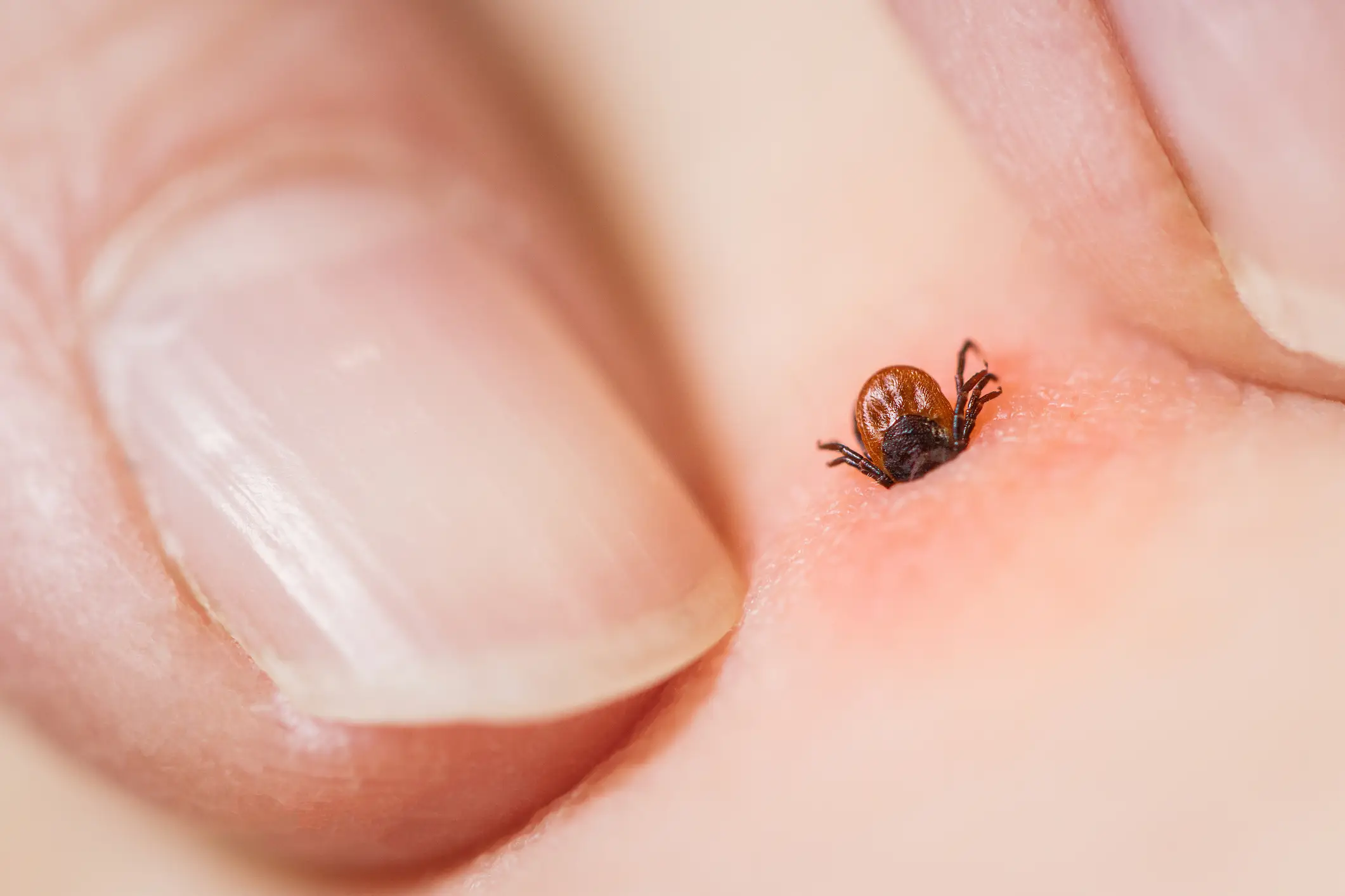Ticks are known for spreading serious illnesses (Getty Stock Image)