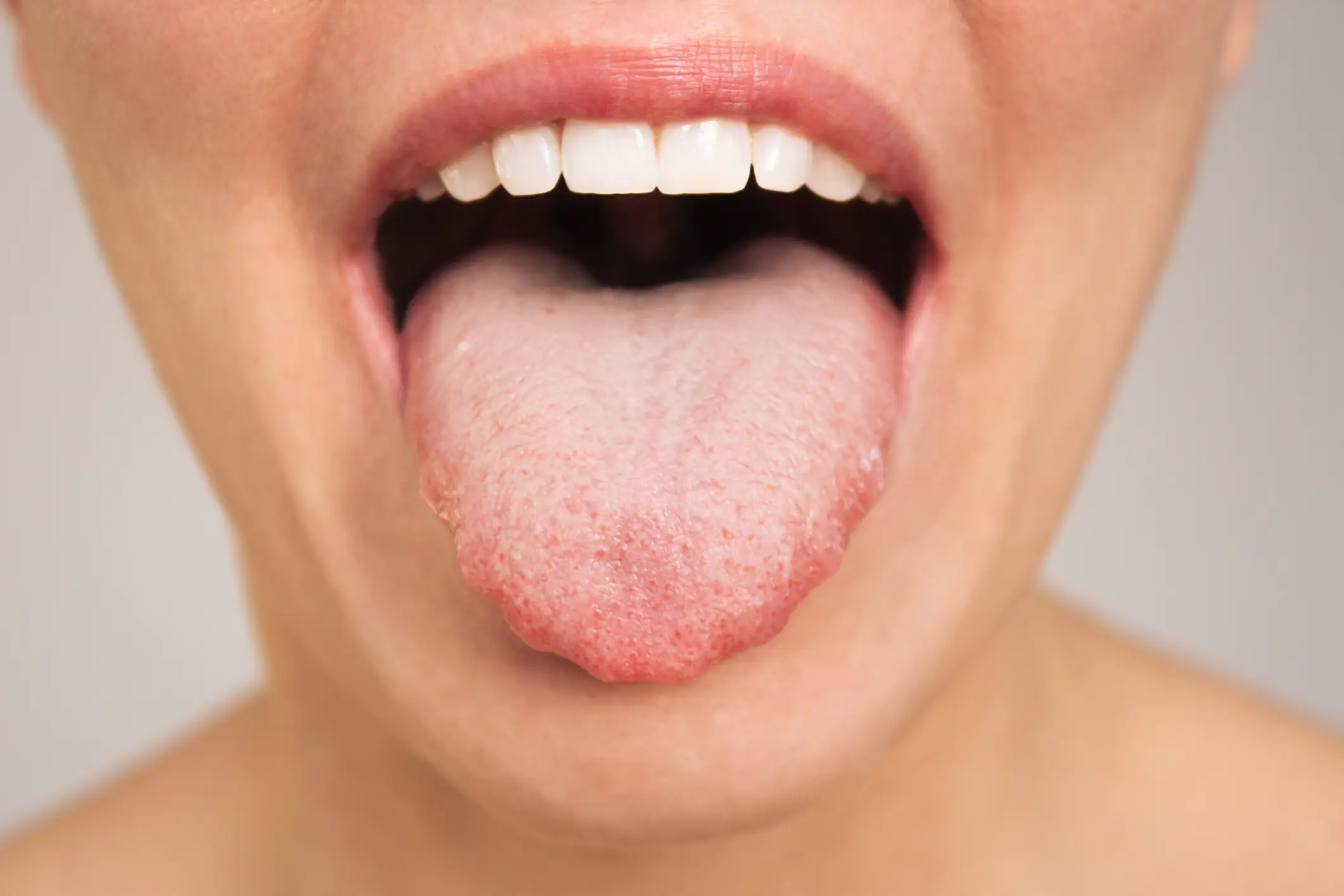 Dry mouth, as well as infections, can contribute to bad breath (Getty Stock Image)