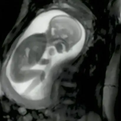 Amazingly clear MRI footage shows a baby casually ‘kicking the sh*t’ out of their mum's organs.