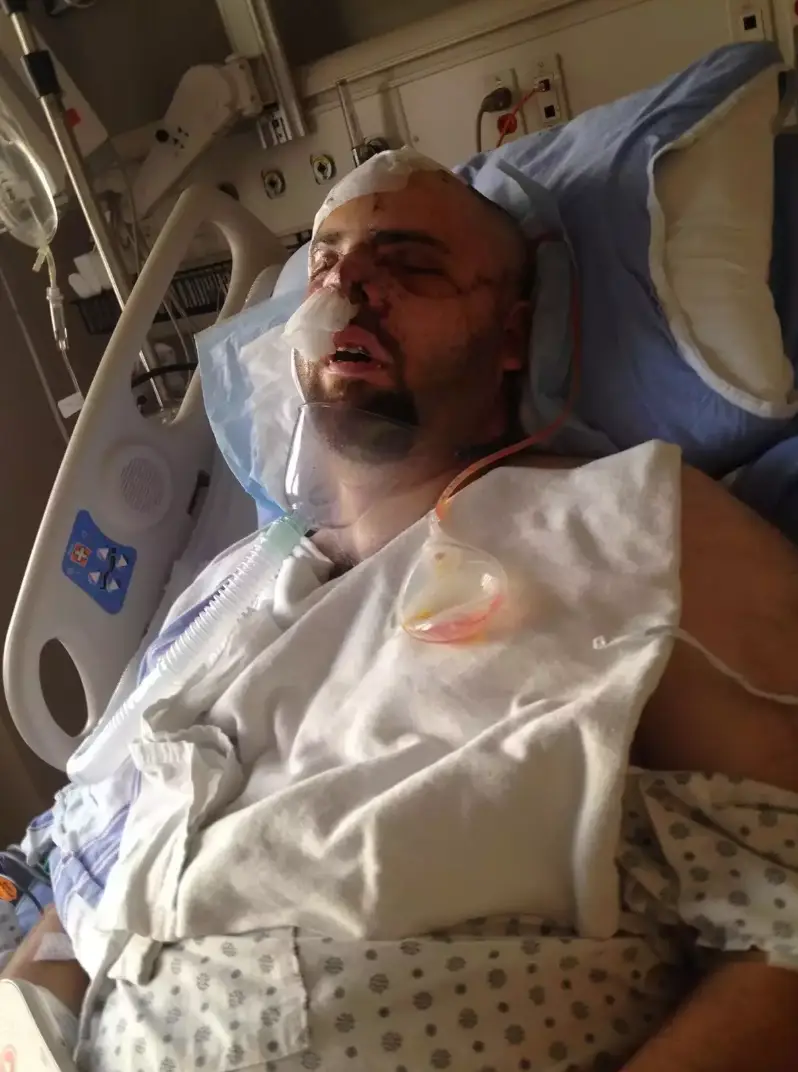 Jeremy was left fighting for his life (Supplied)