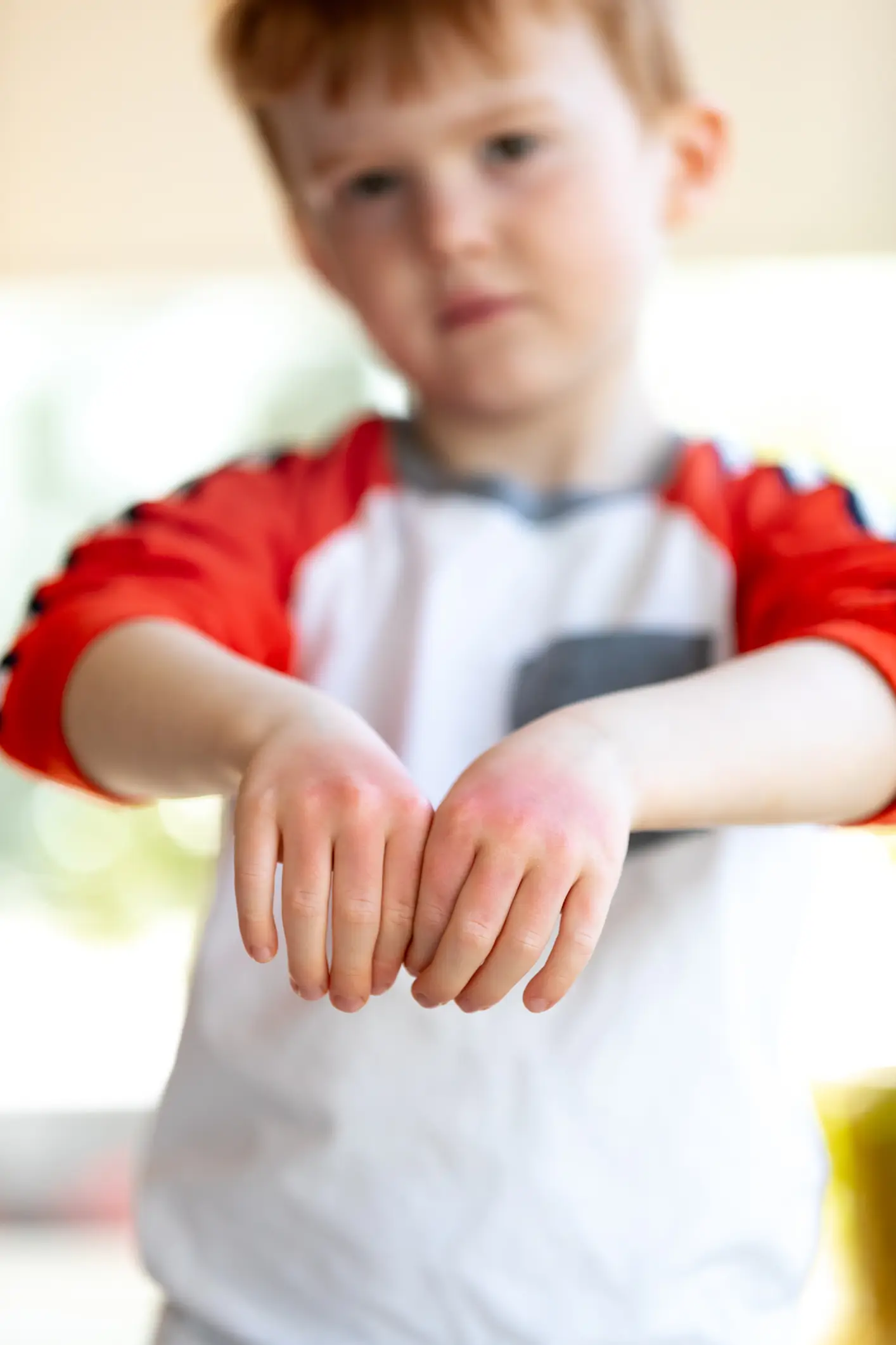 Laura Abbott says the Shriners Children's Boston hospital has seen more burn cases (Getty Stock Images)
