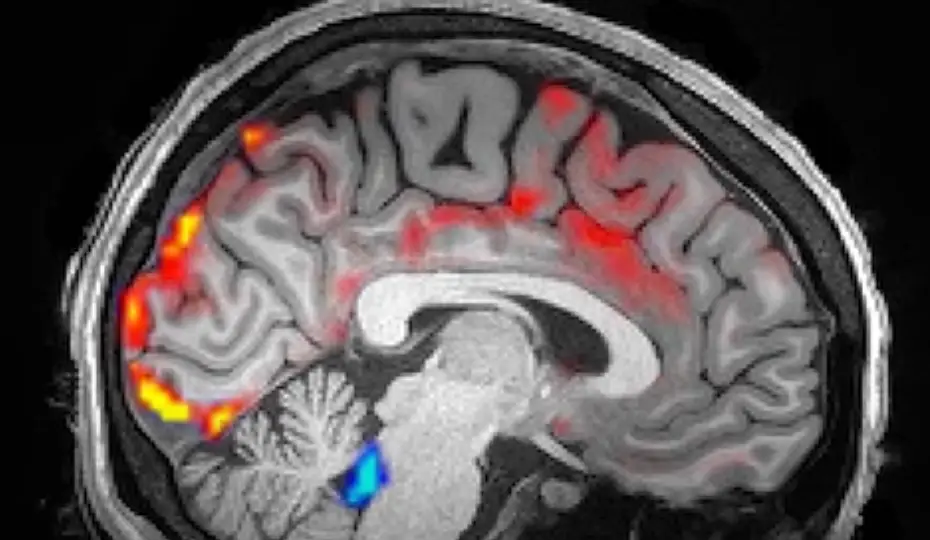 The CSF (blue) helps clear out 'harmful proteins' from the brain (Laura Lewis, N. Fultz et al/Science 2019)