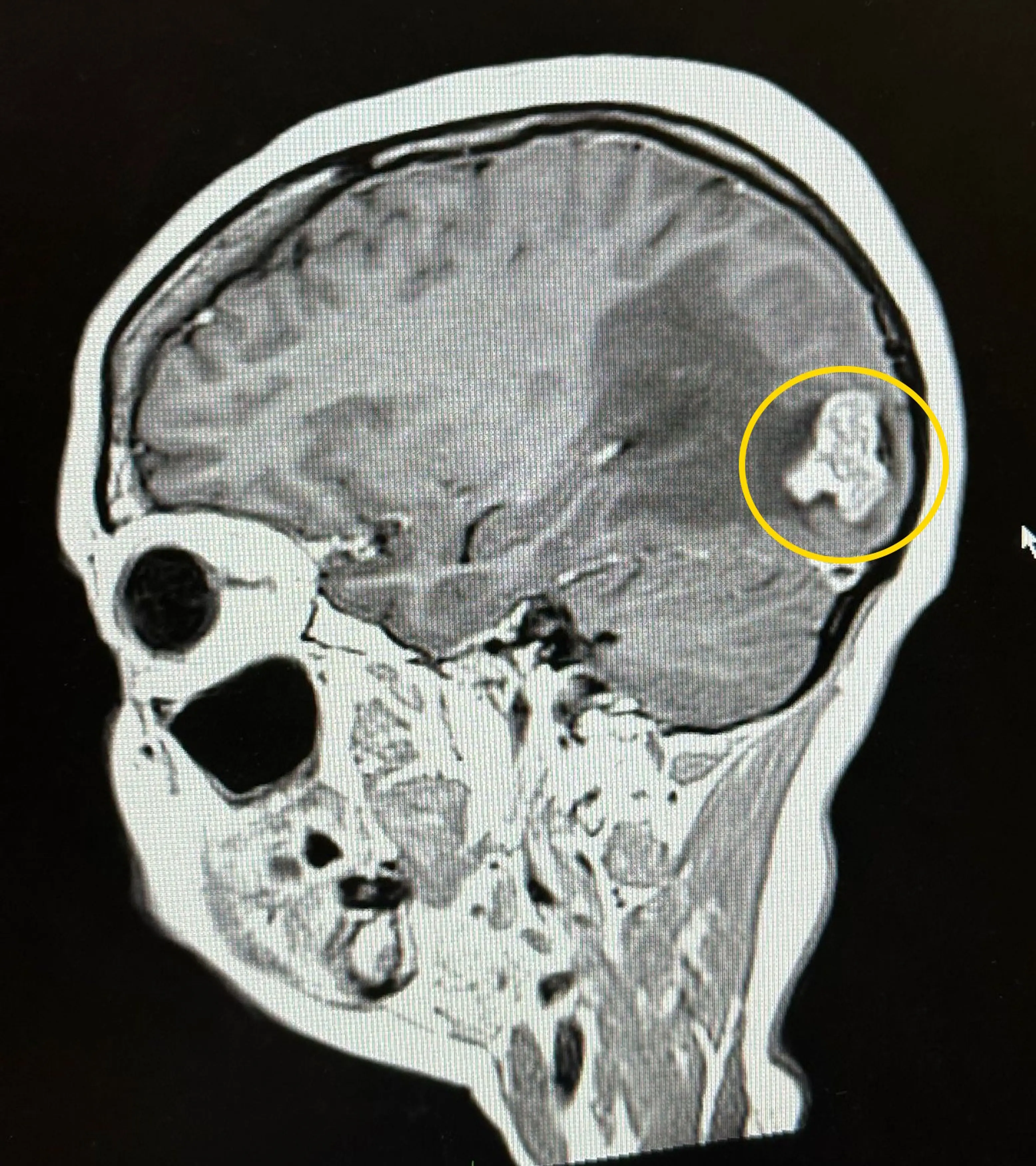 Kimberley got the heartbreaking news that she had a brain tumor in 2024 (Kennedy News & Media)