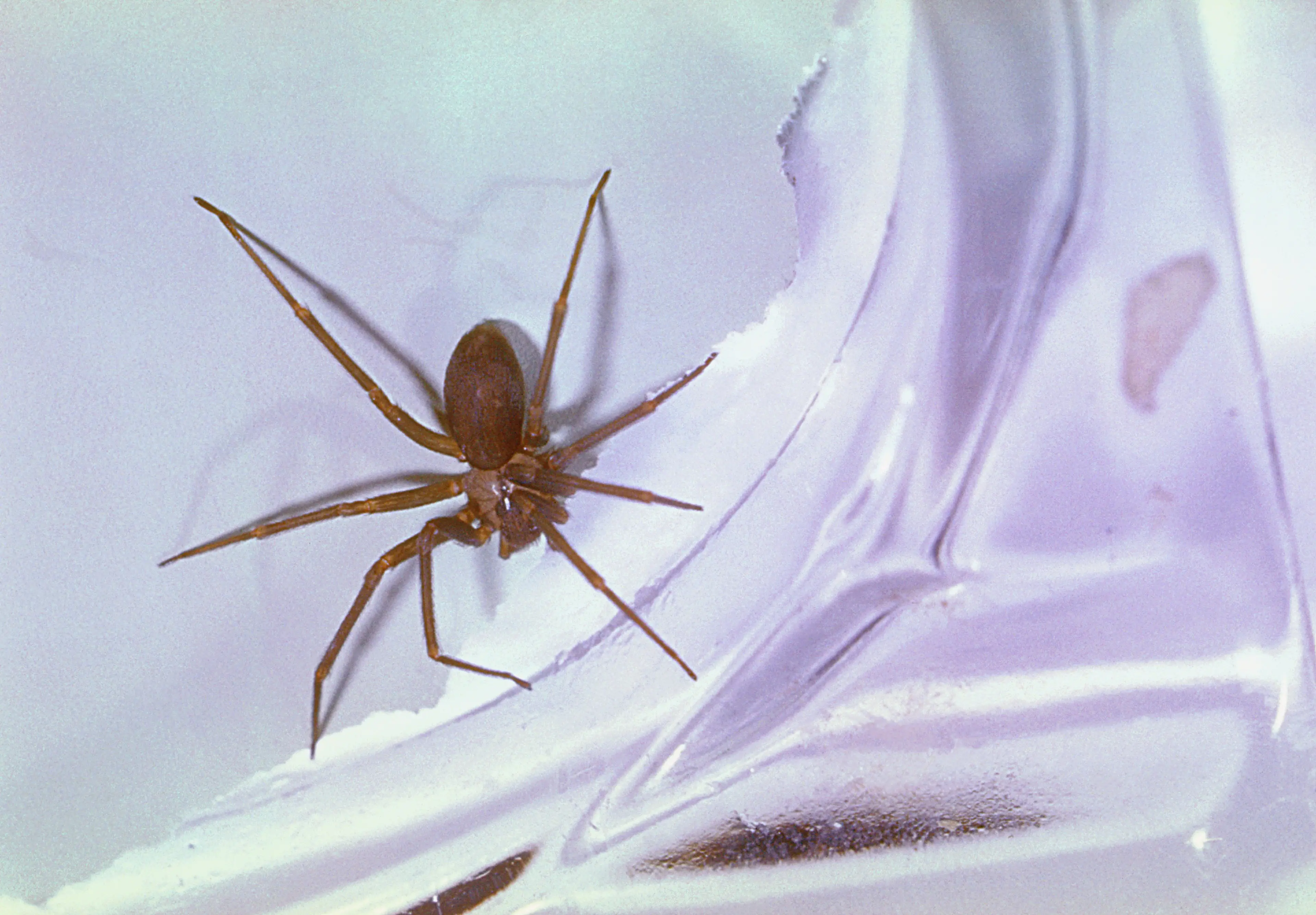 Doctors initially thought Zachary had been bitten by a brown recluse spider. (Smith Collection/Gado/Getty Images)